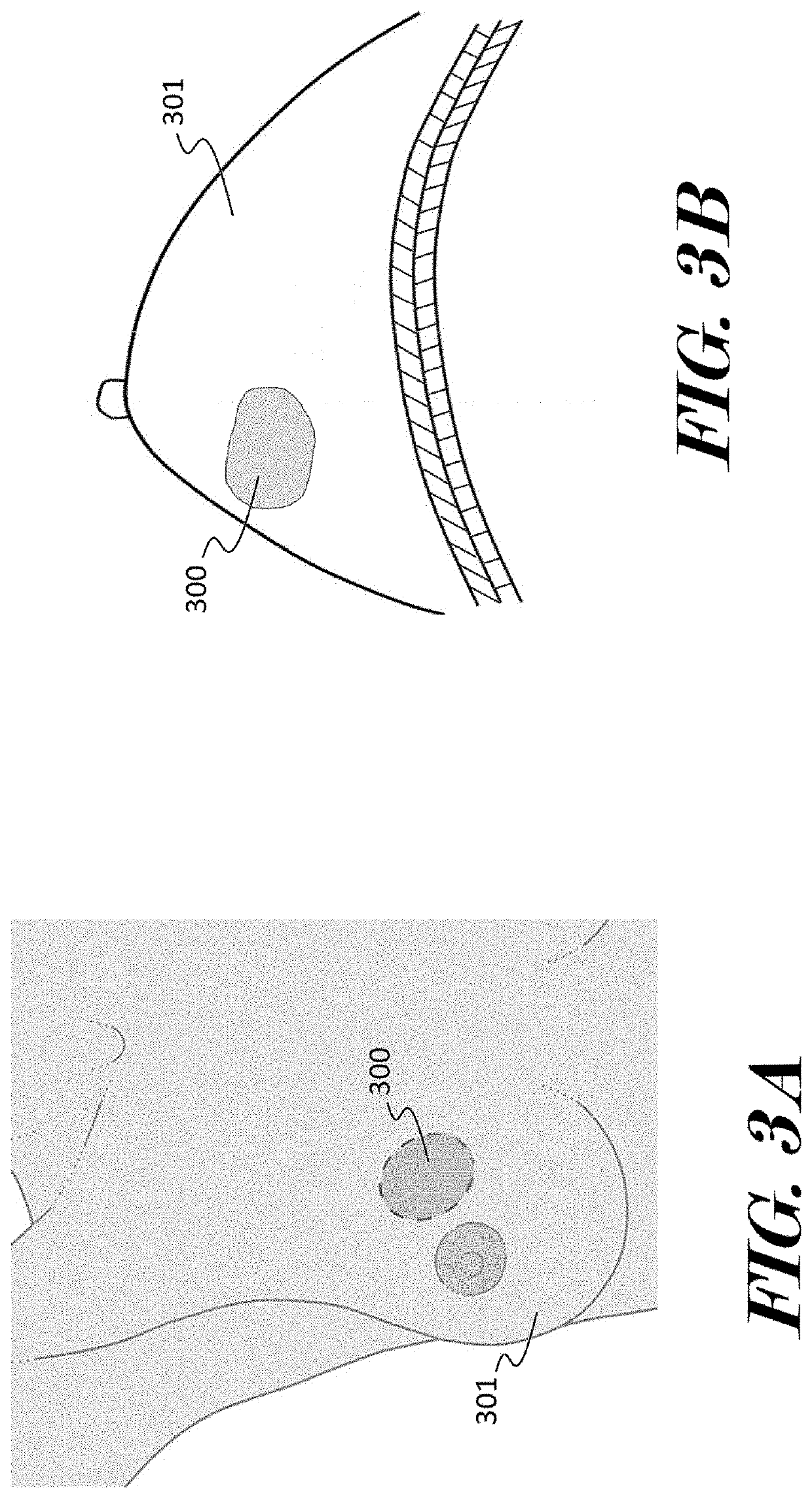 Method of identifying tumor drug resistance during treatment