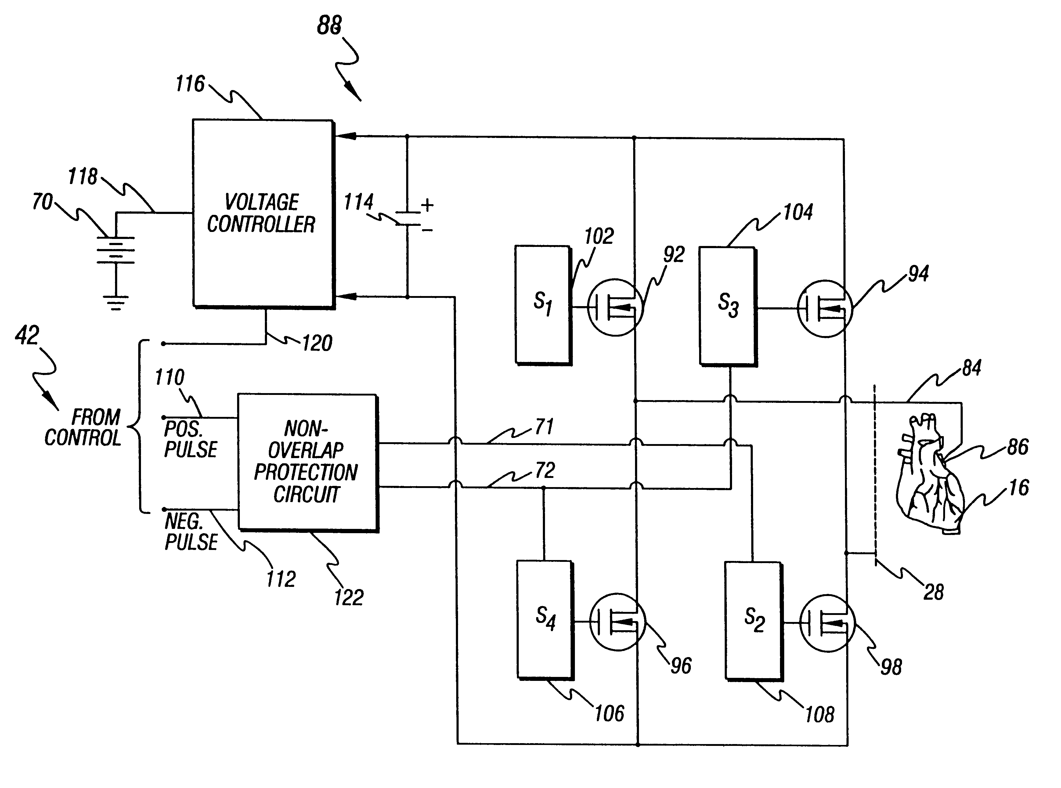 Method and apparatus for treatment of cardiac electromechanical dissociation