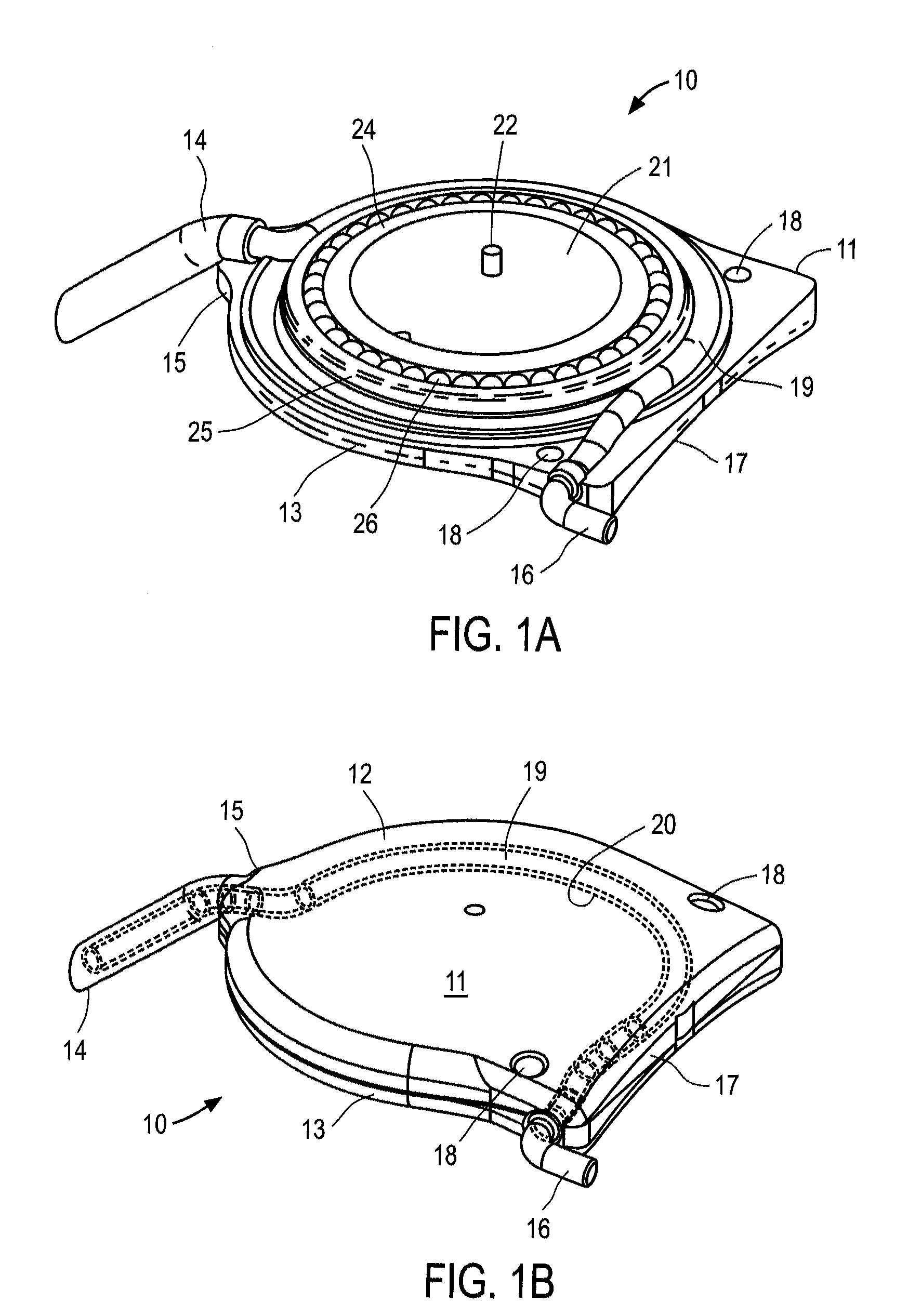 Apparatus and methods for treating excess intraocular fluid