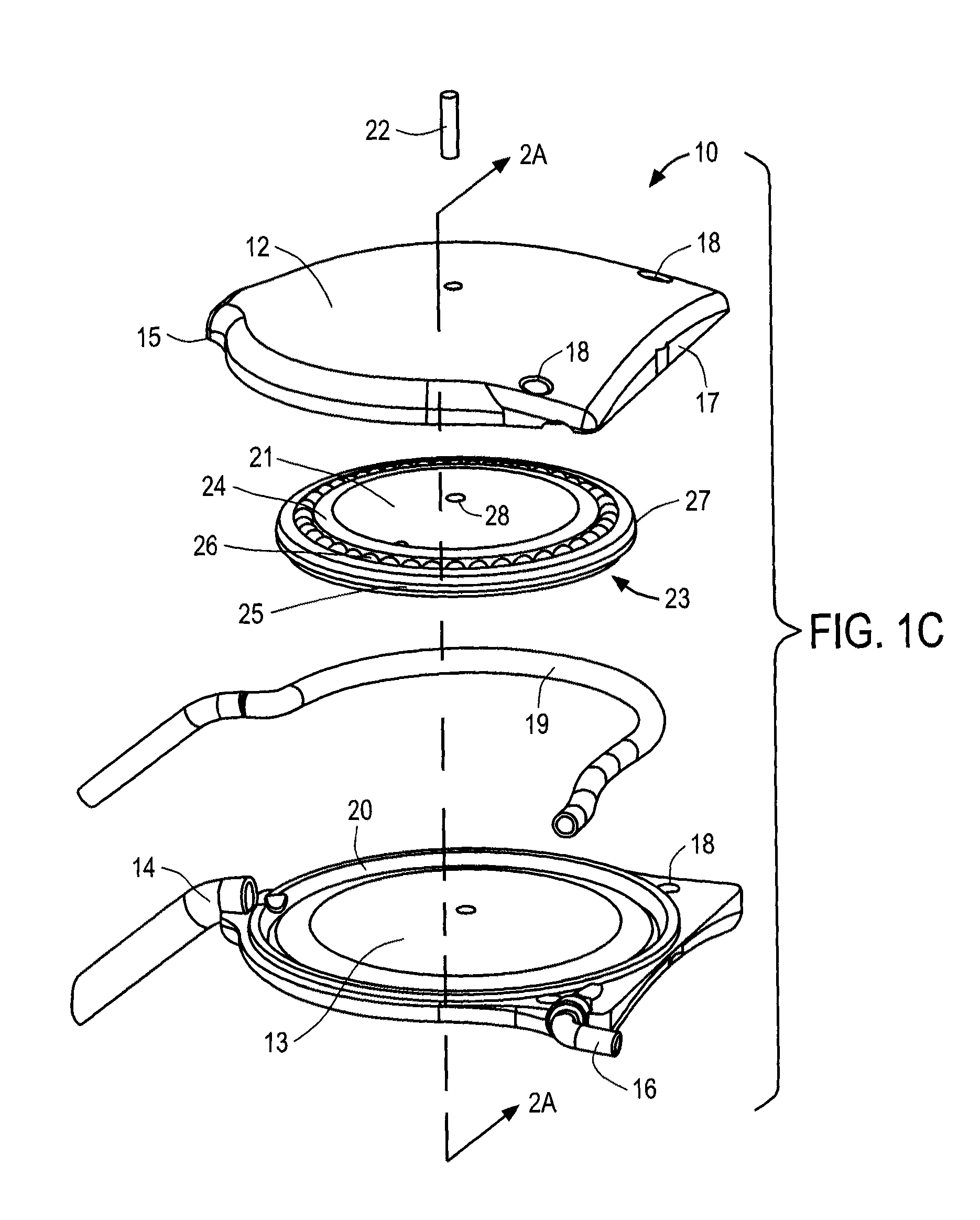 Apparatus and methods for treating excess intraocular fluid