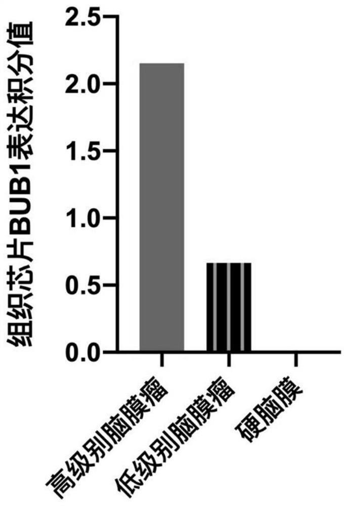 Application of BUB1 protein in preparation of high-grade meningioma prognosis evaluation reagent or kit