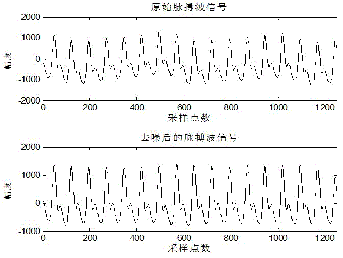 Continuous blood pressure measuring device based on pulse waves