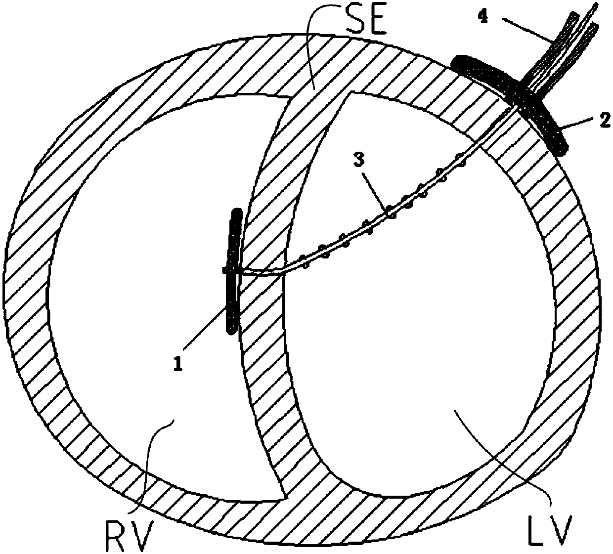 Medical device