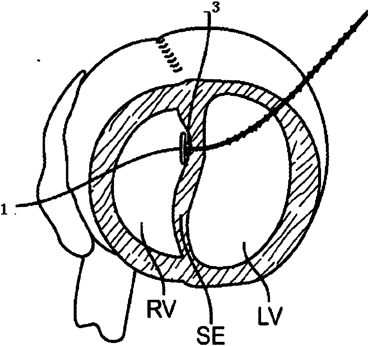 Medical device