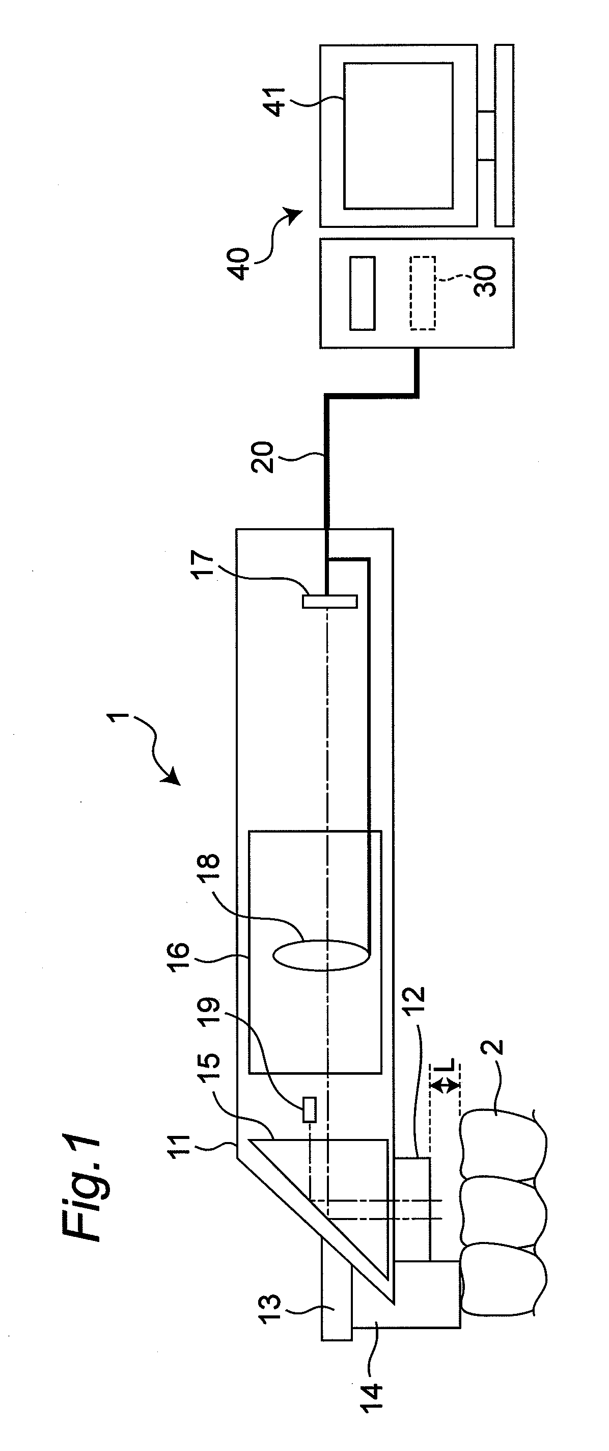 Intra-oral measurement device and intra-oral measurement system