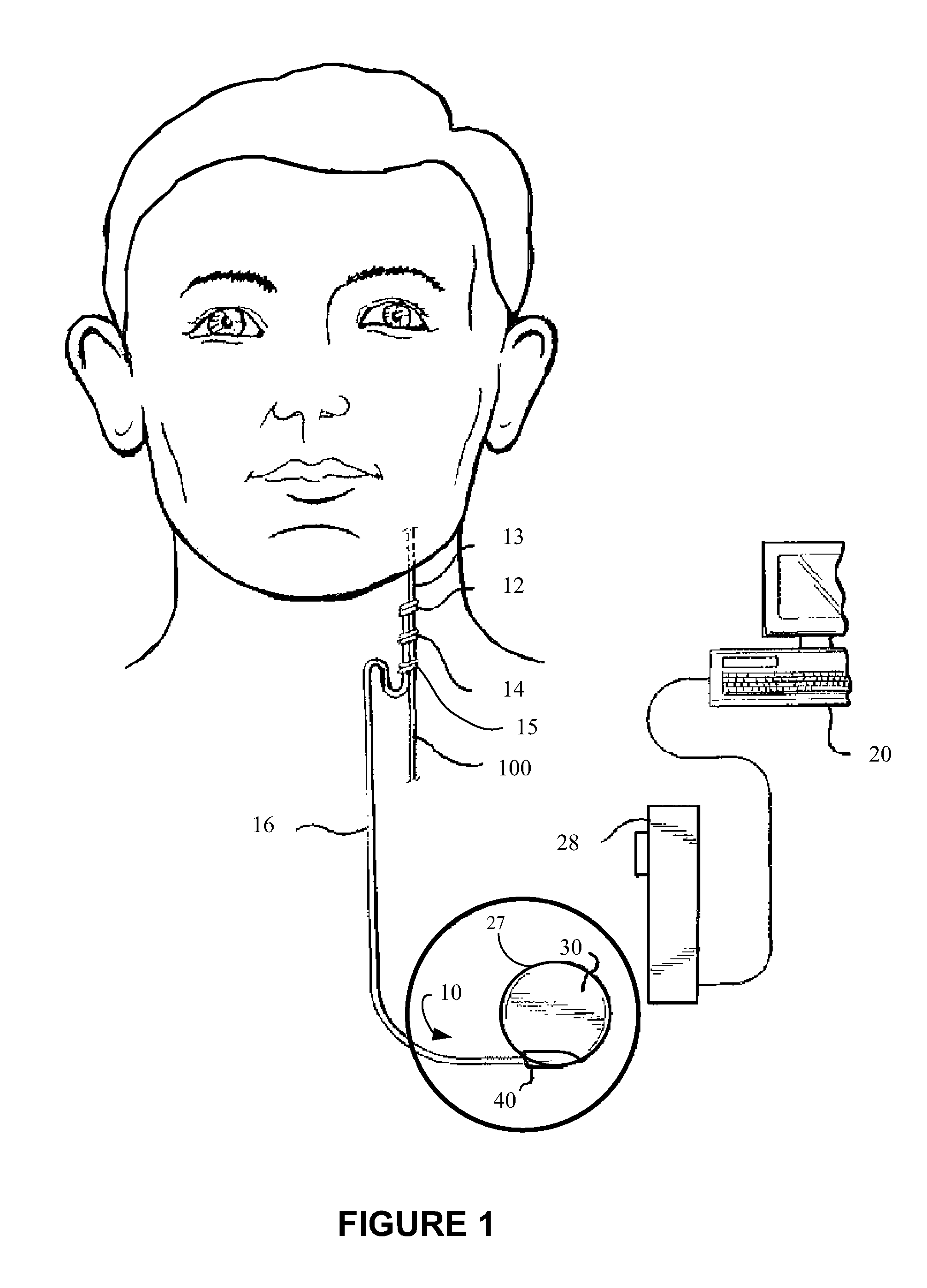 Implantable medical device having multiple electrode/sensor capability and stimulation based on sensed intrinsic activity