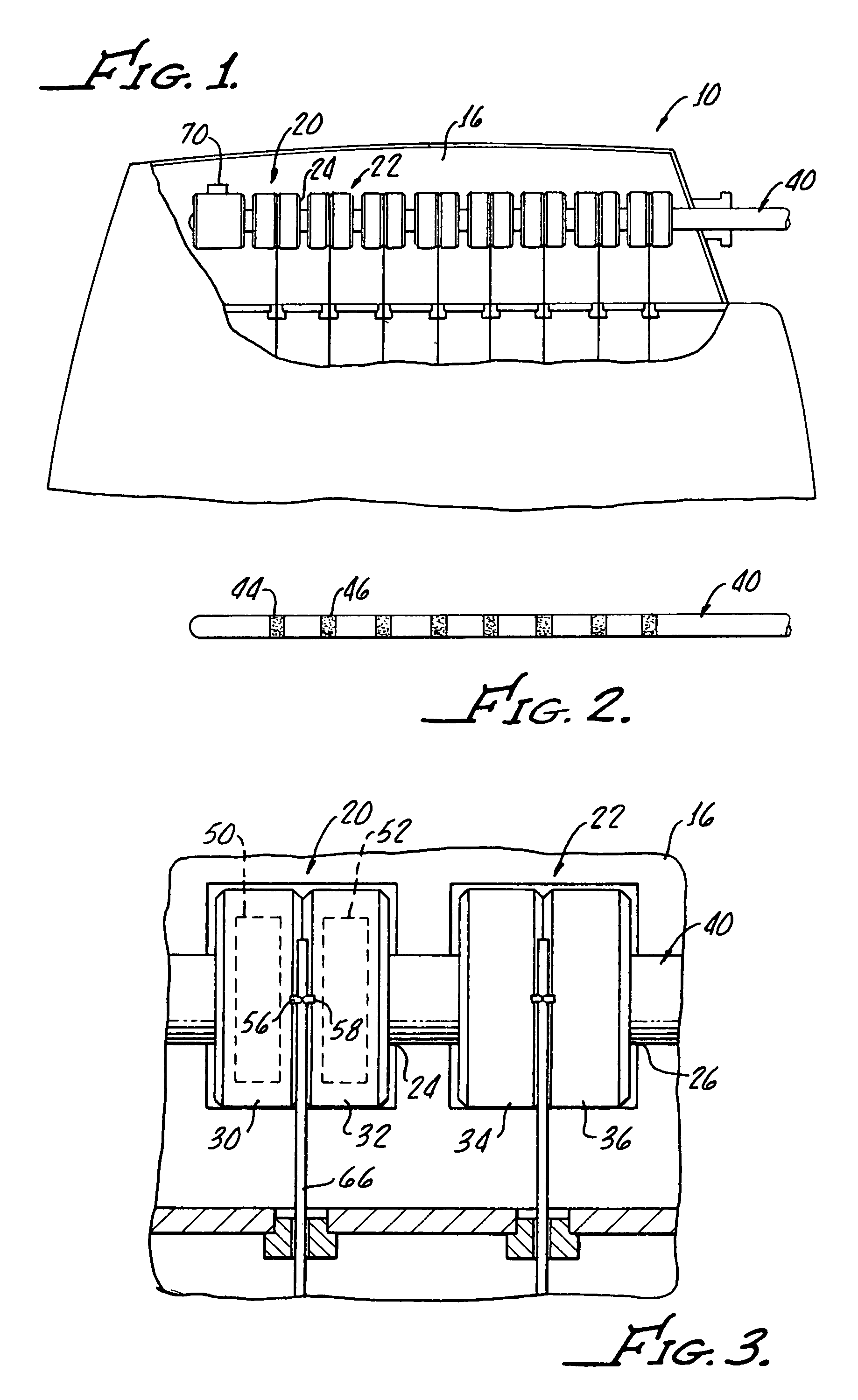 Pigtail spring contacts for implanted medical devices