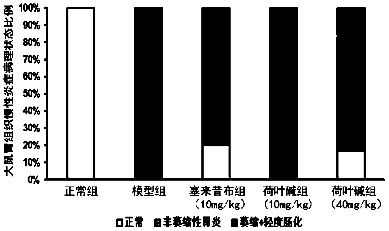 Application of nuciferine and lotus leaf extract for preparing drug for treating atrophic gastritis and/or blocking transformation of gastritis cancer