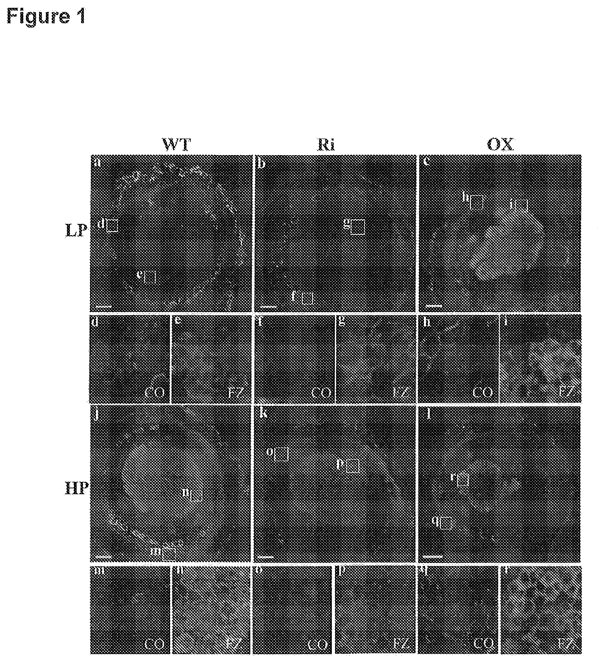 Expression of a phosphate transporter for improving plant yield