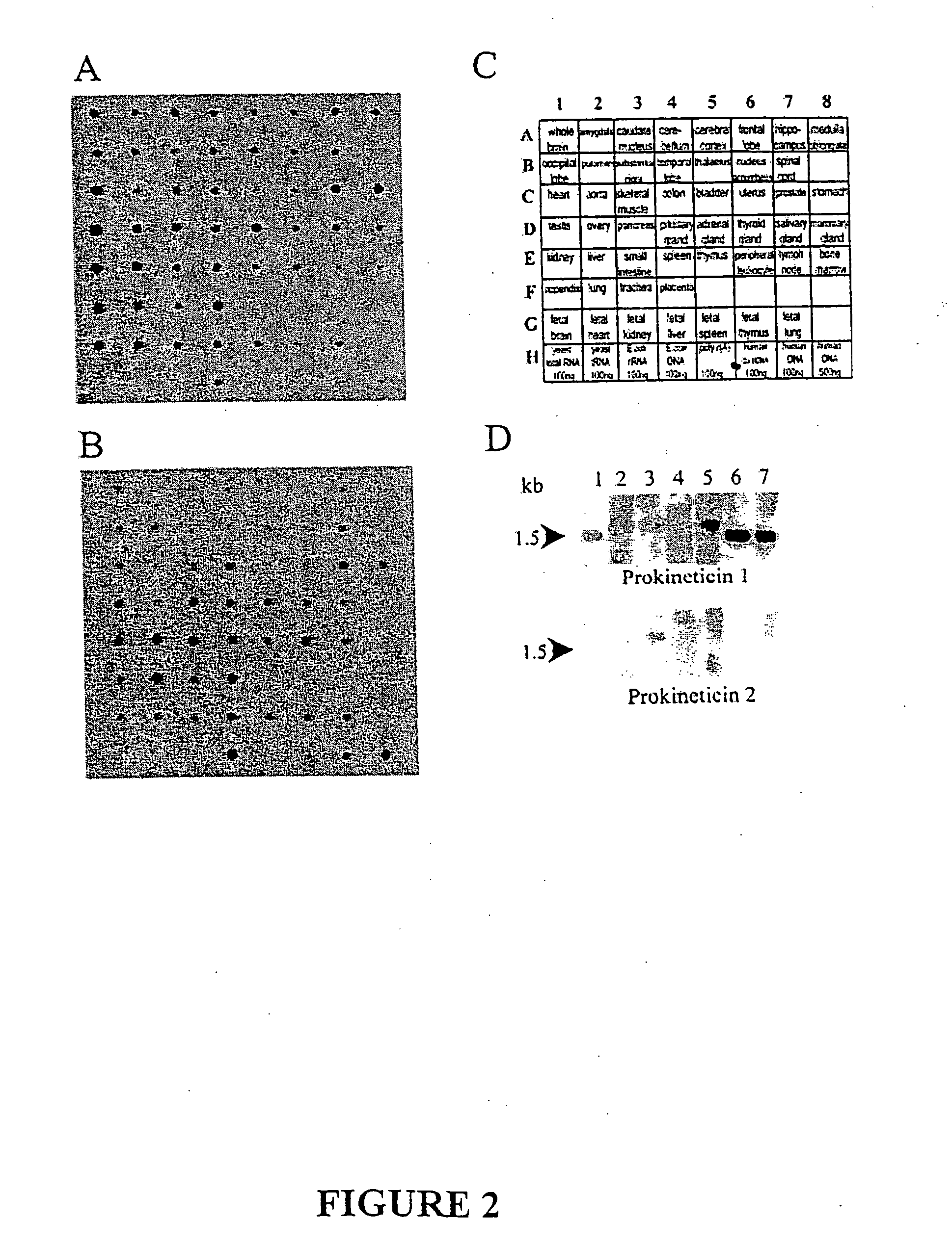 Prokineticin polypeptides, related compositions and methods