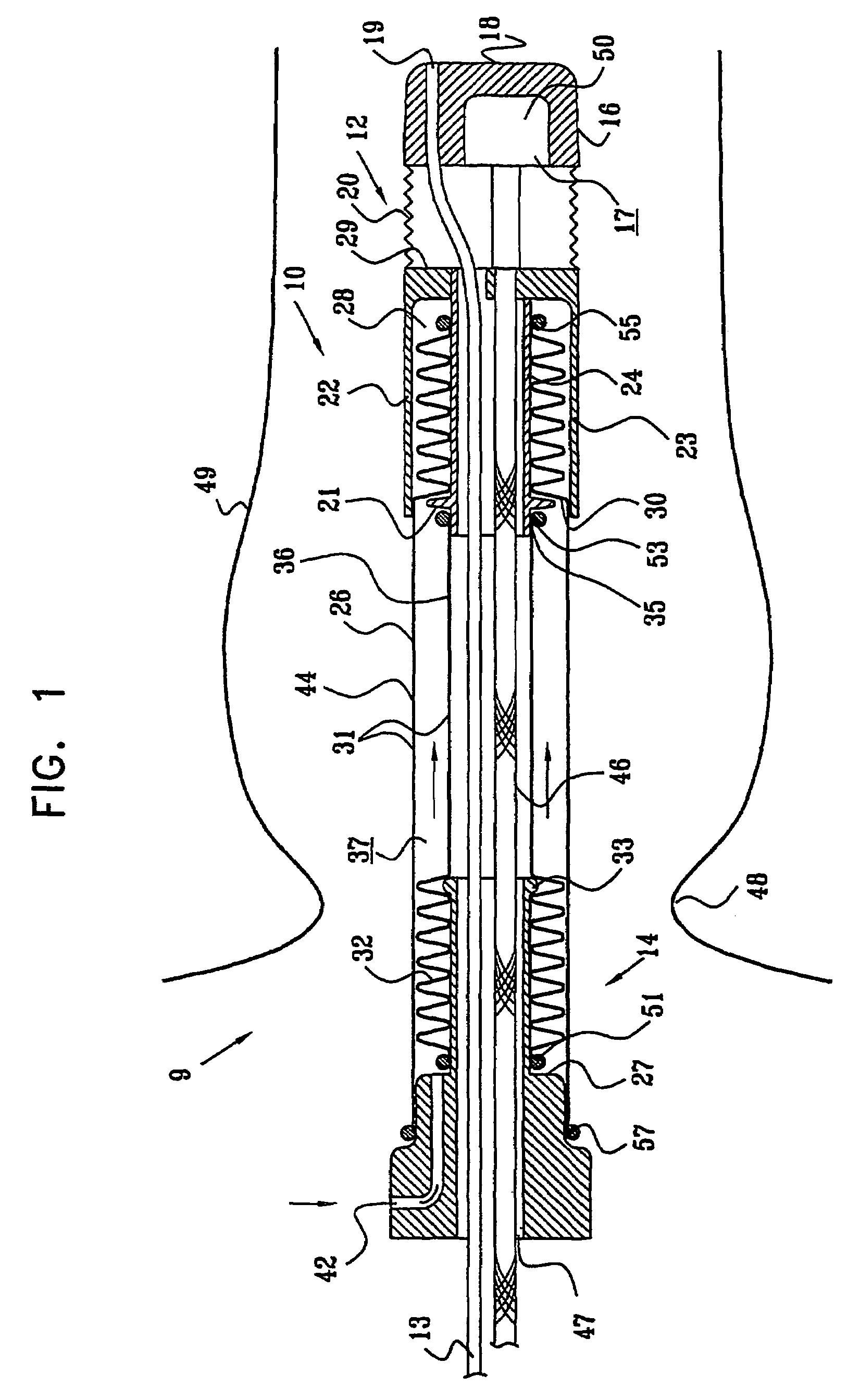 Double sleeve endoscope