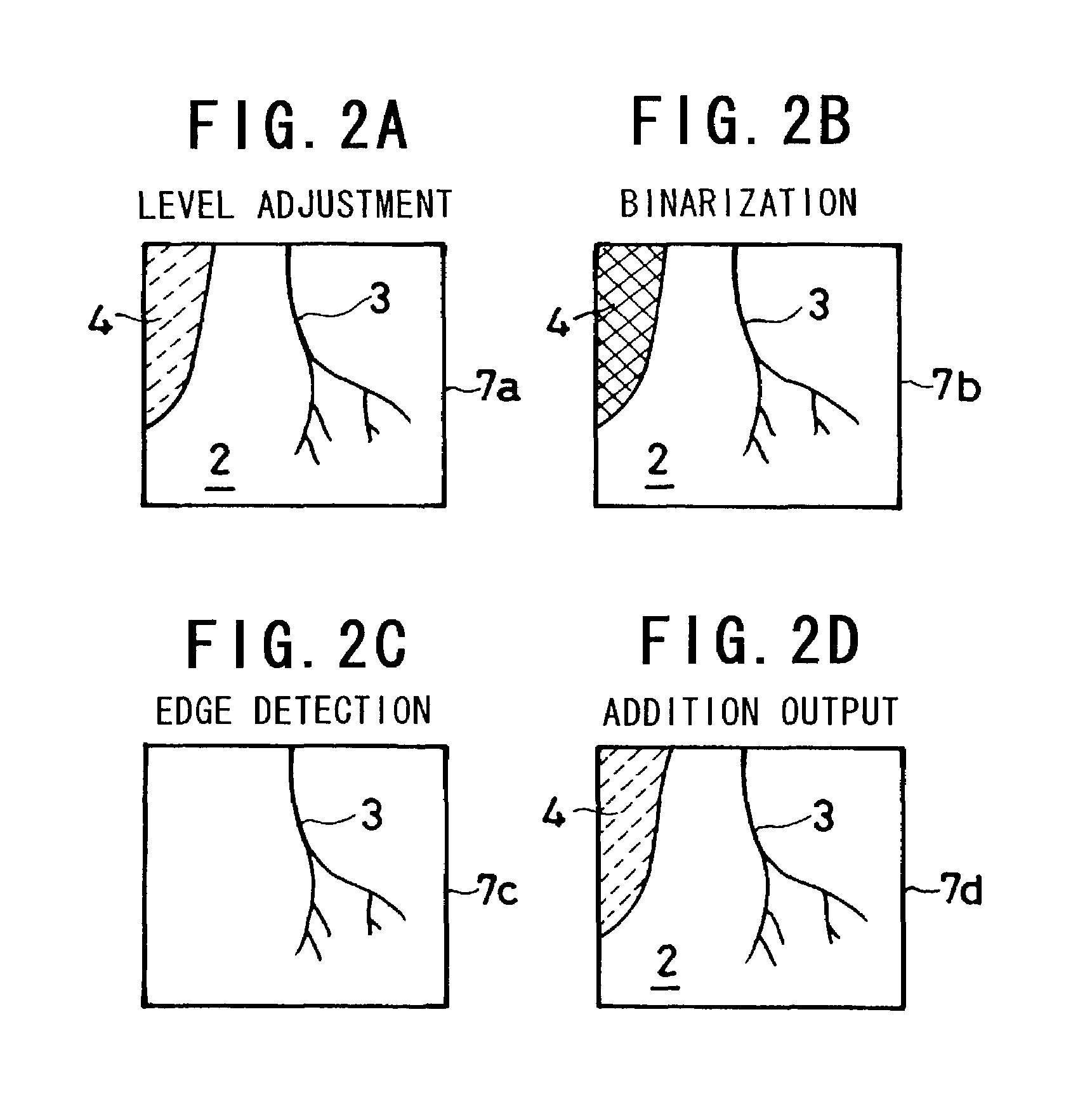 Electronic endoscope for highlighting blood vessel