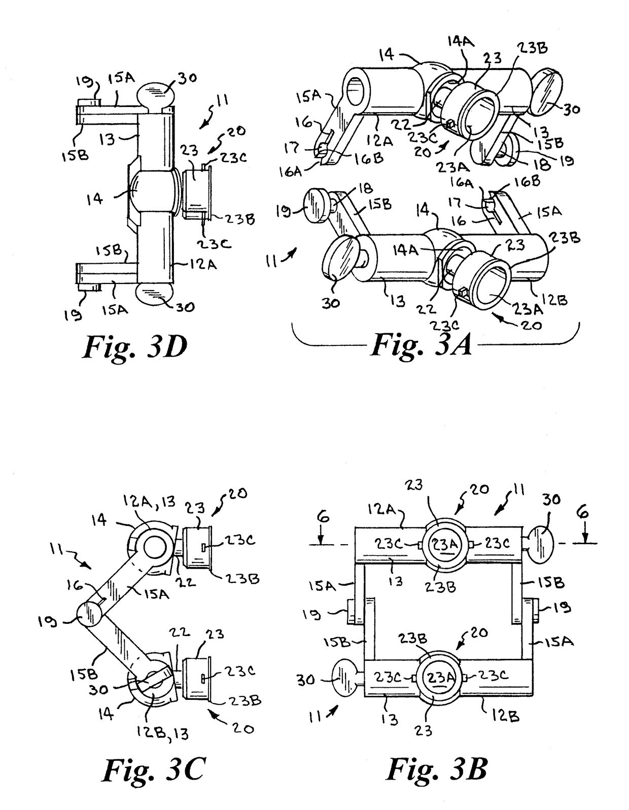 Dental articulator