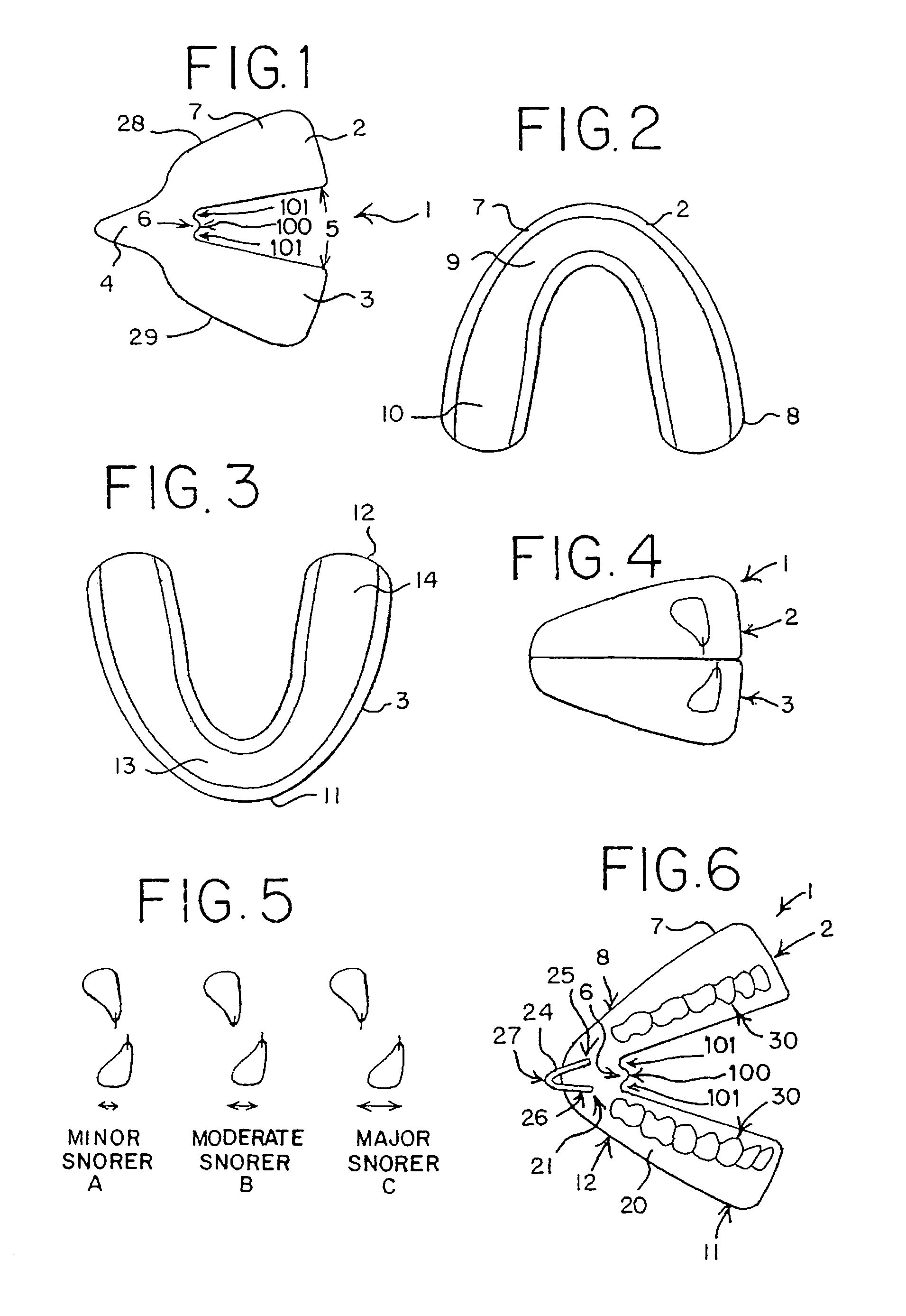 Appliance, system and method for preventing snoring