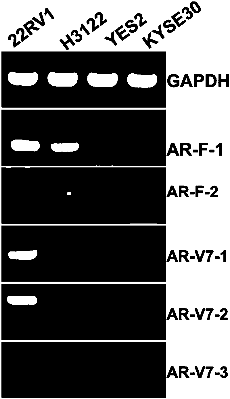 Primer and probe for detecting AR-V7 and AR in vesicle based on qPCR or digital PCR technology