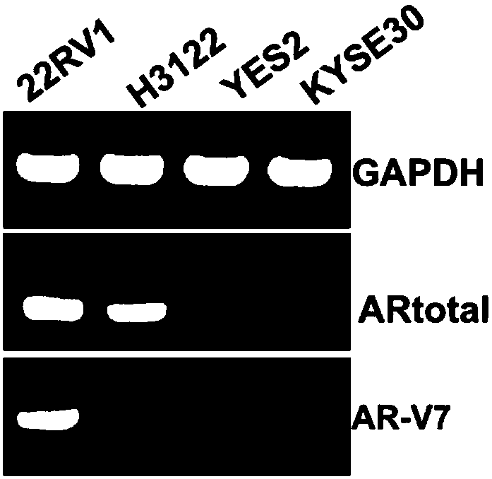 Primer and probe for detecting AR-V7 and AR in vesicle based on qPCR or digital PCR technology