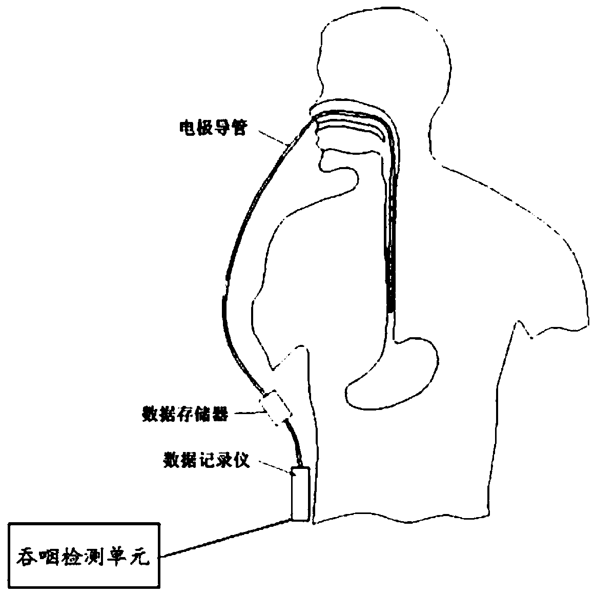 Automatic identification of gastroesophageal swallowing device and method