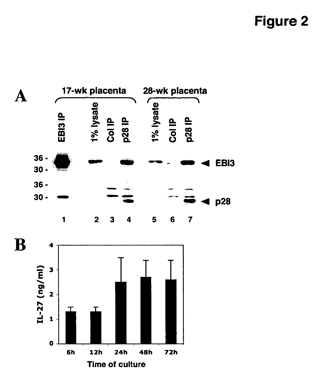 Methods of modulating maternal-fetal tolerance