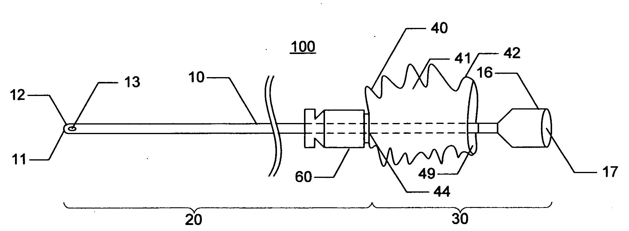 Urinary catheterization assembly with open ended sheath