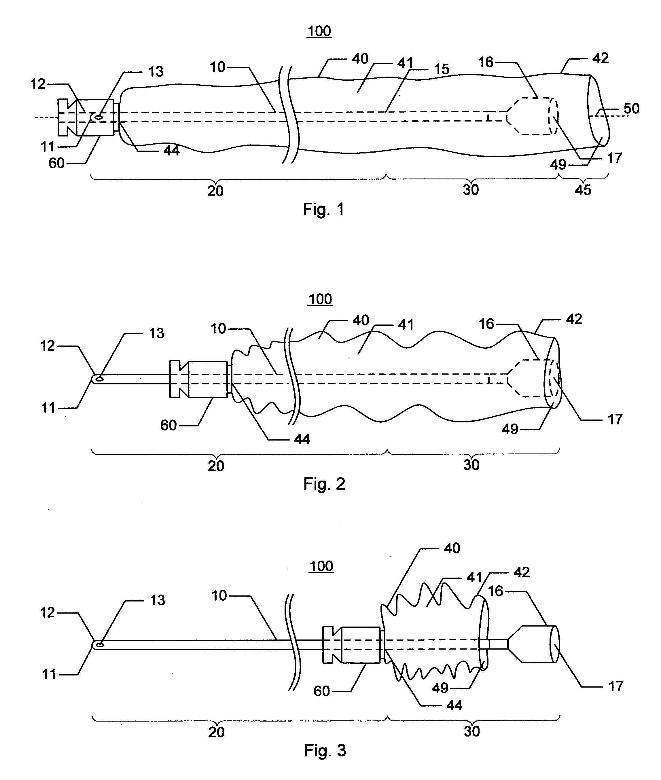 Urinary catheterization assembly with open ended sheath