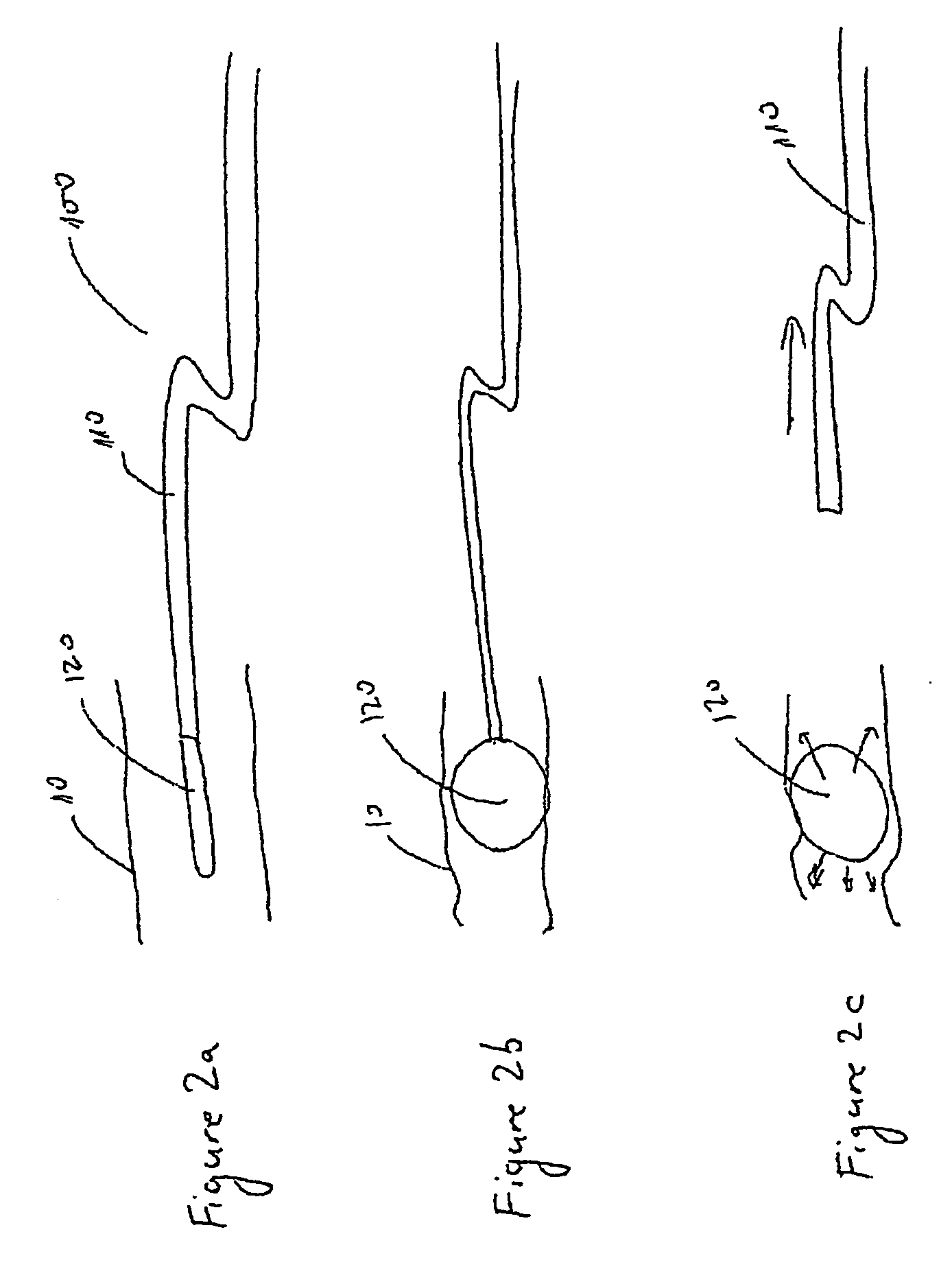 Directional Anchoring Mechanism, Method and Applications Thereof