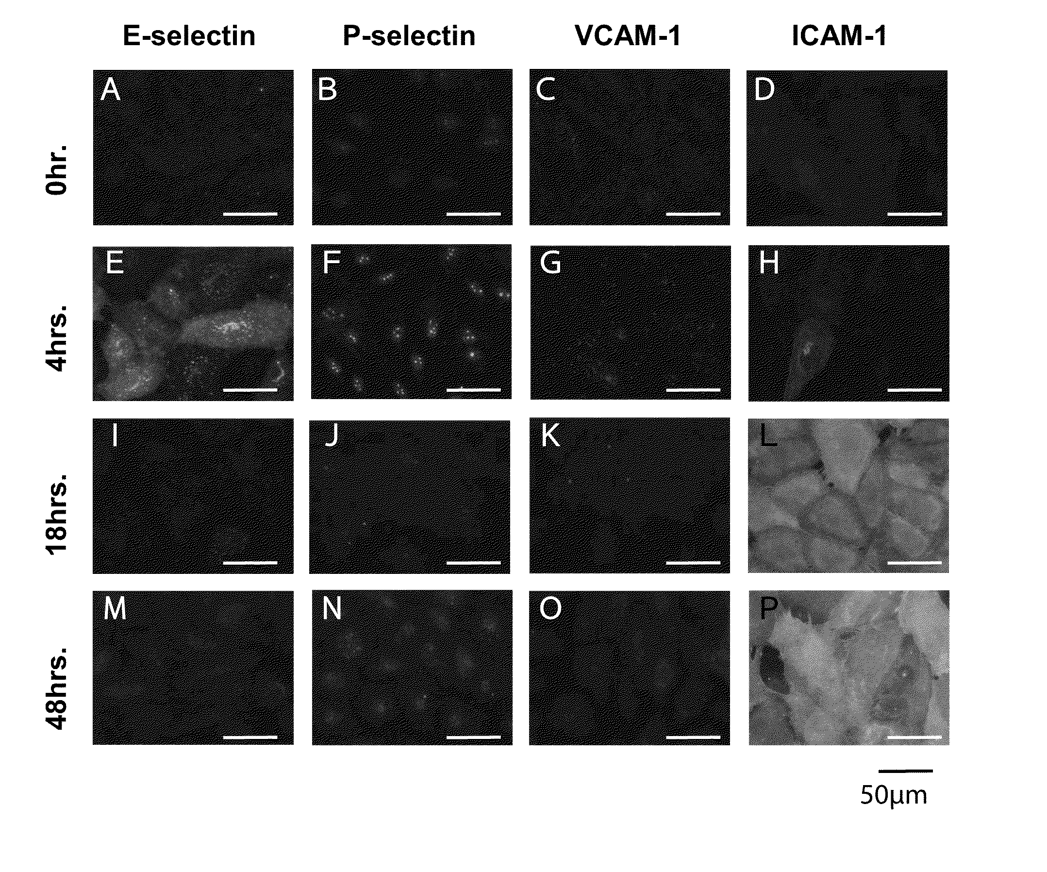 Kit for detecting cancer cells metastasizing into sentinel lymph node