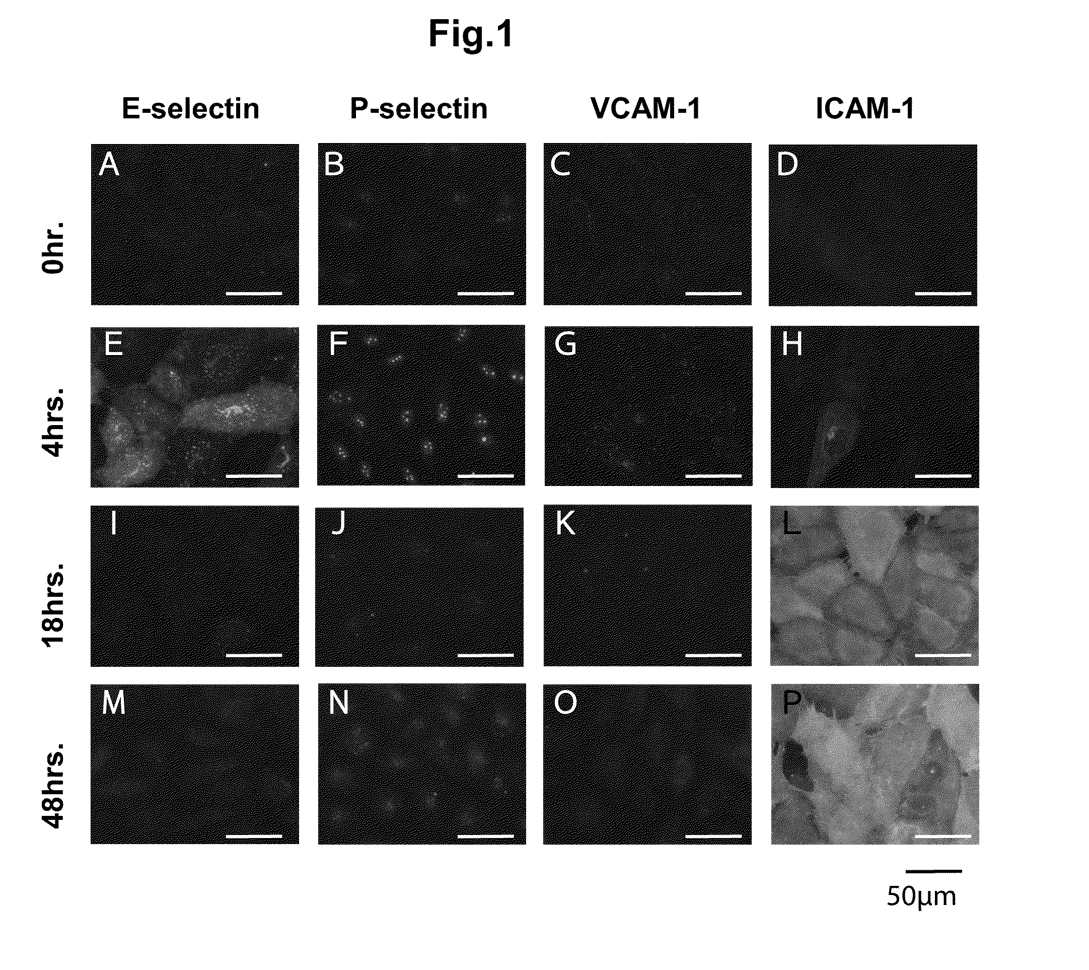 Kit for detecting cancer cells metastasizing into sentinel lymph node