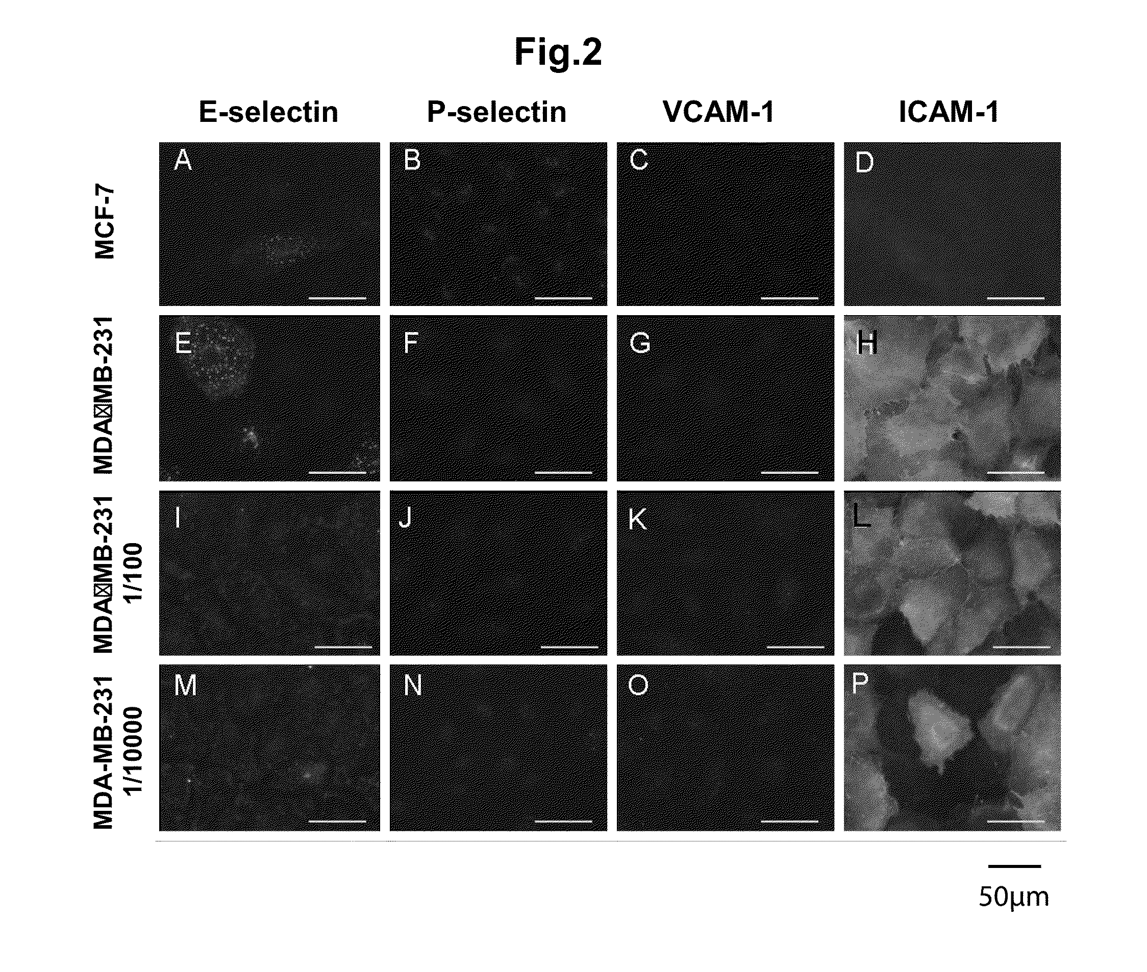 Kit for detecting cancer cells metastasizing into sentinel lymph node