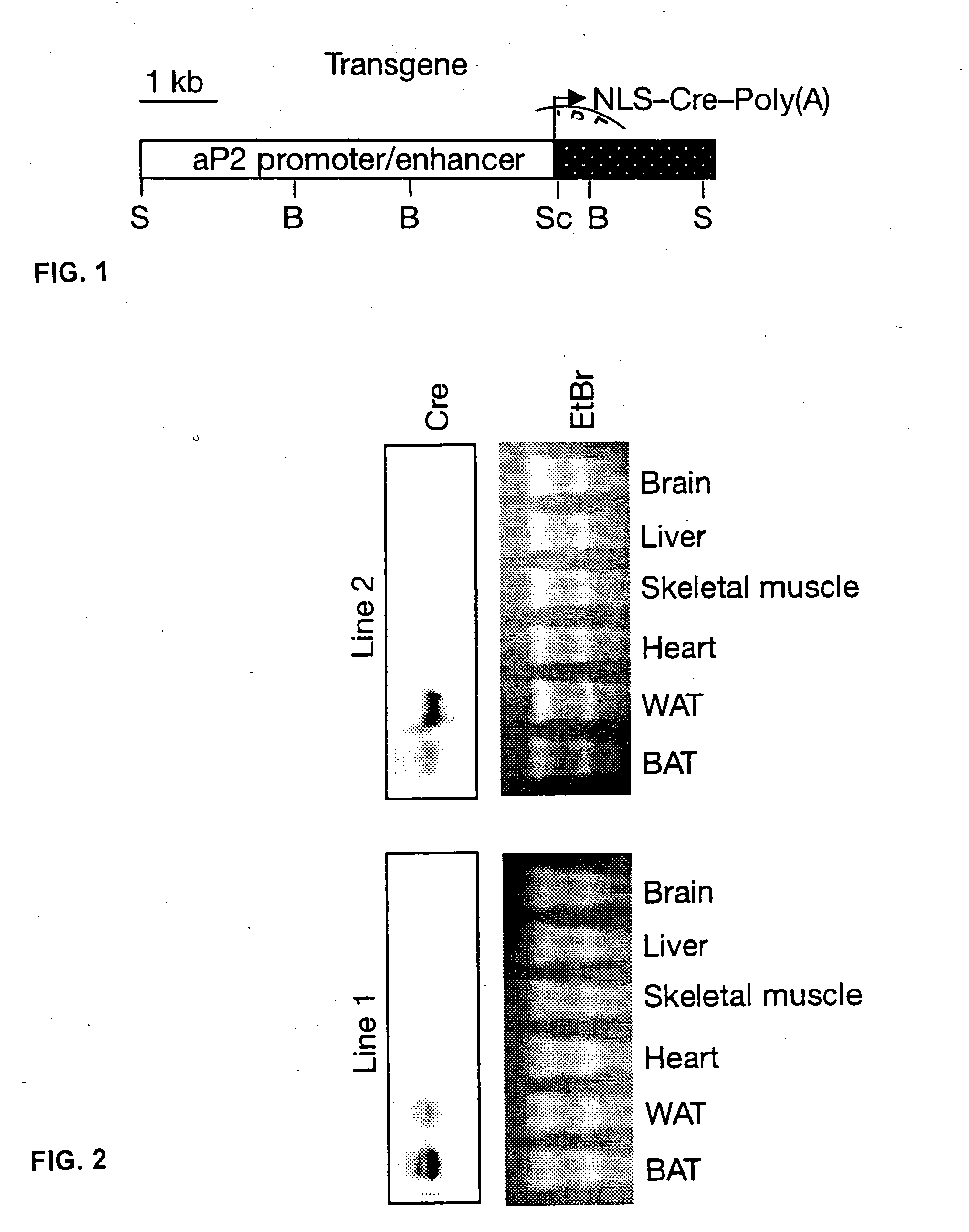 RBP4 in insulin sensitivity/resistance, diabetes, and obesity