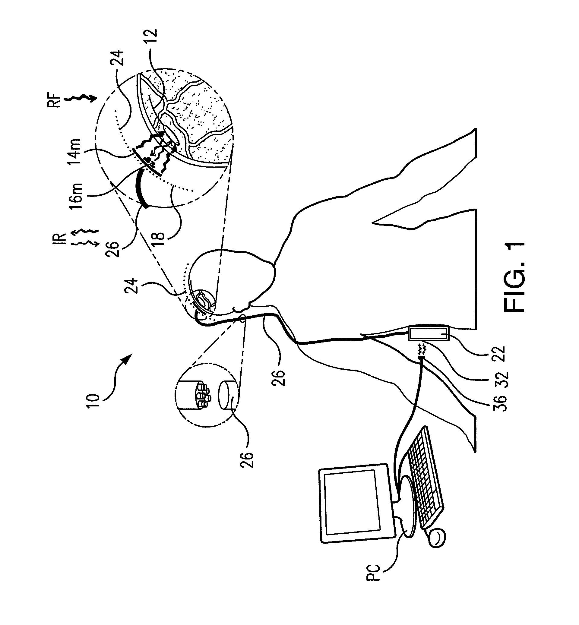 Wireless system for epilepsy monitoring and measurement