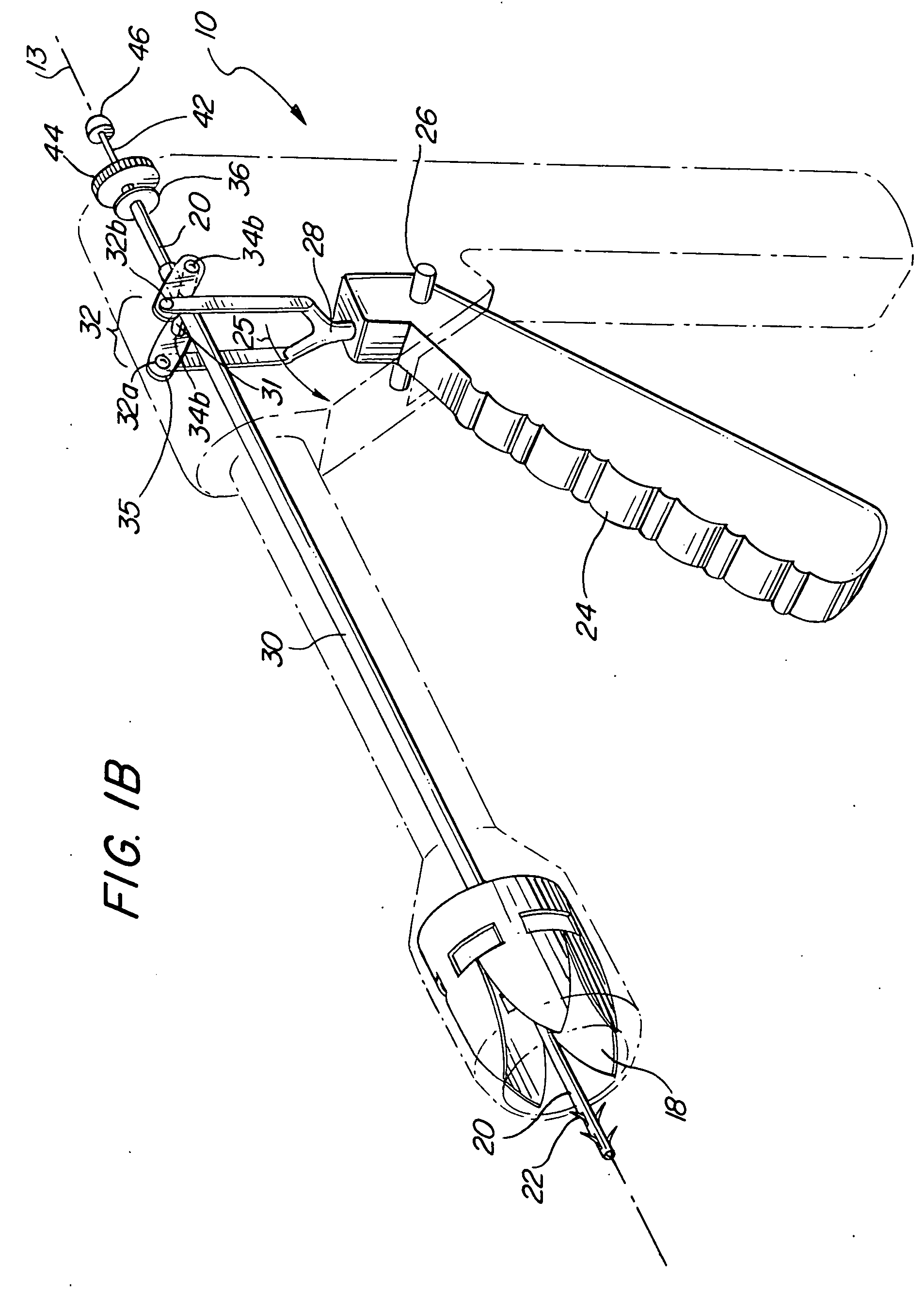 Cervical conization device