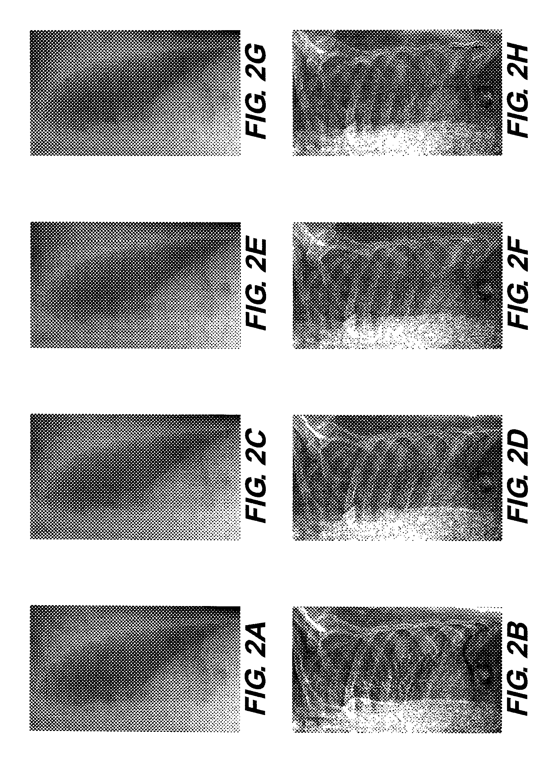 Registration method for projections in dual energy