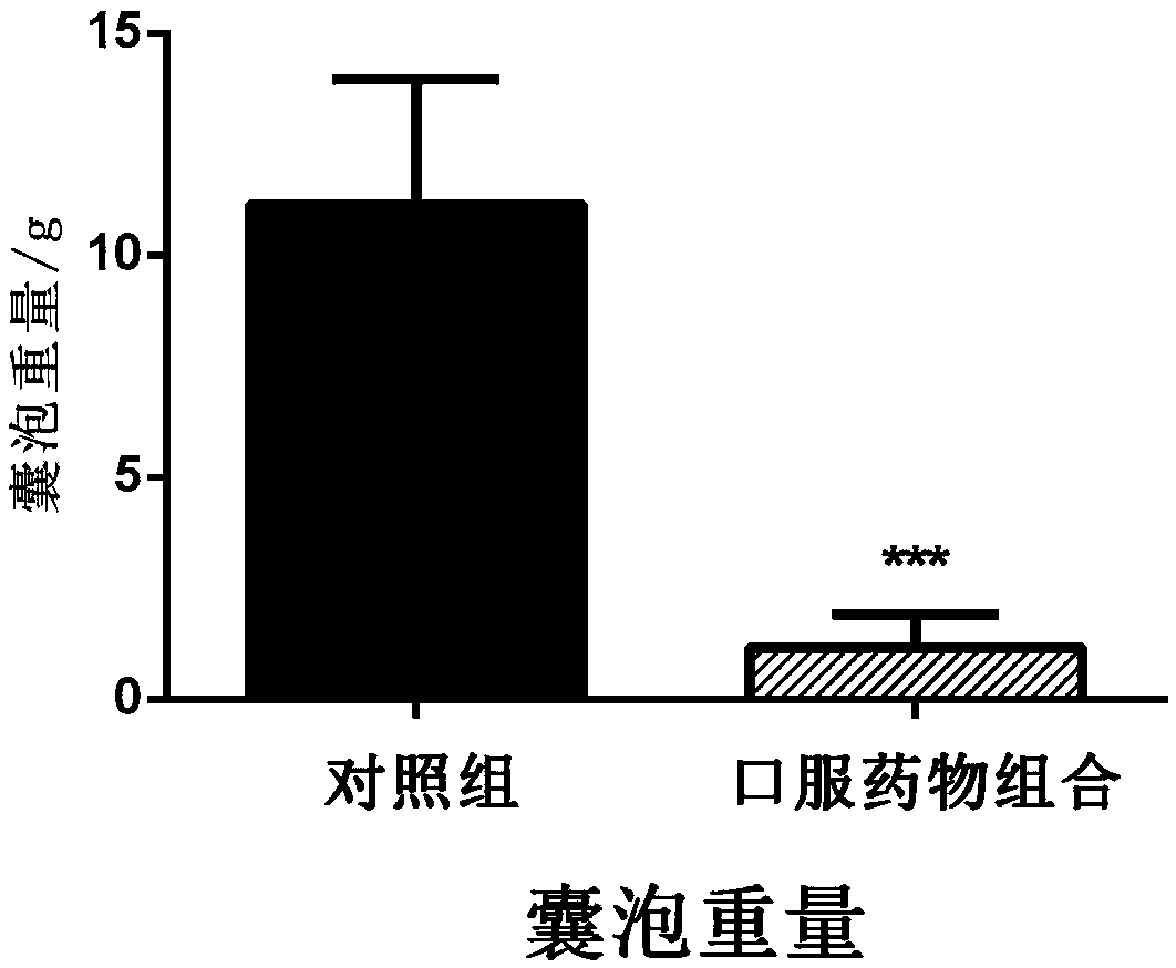 Echinococcosis treating drug combination and preparation, and application thereof