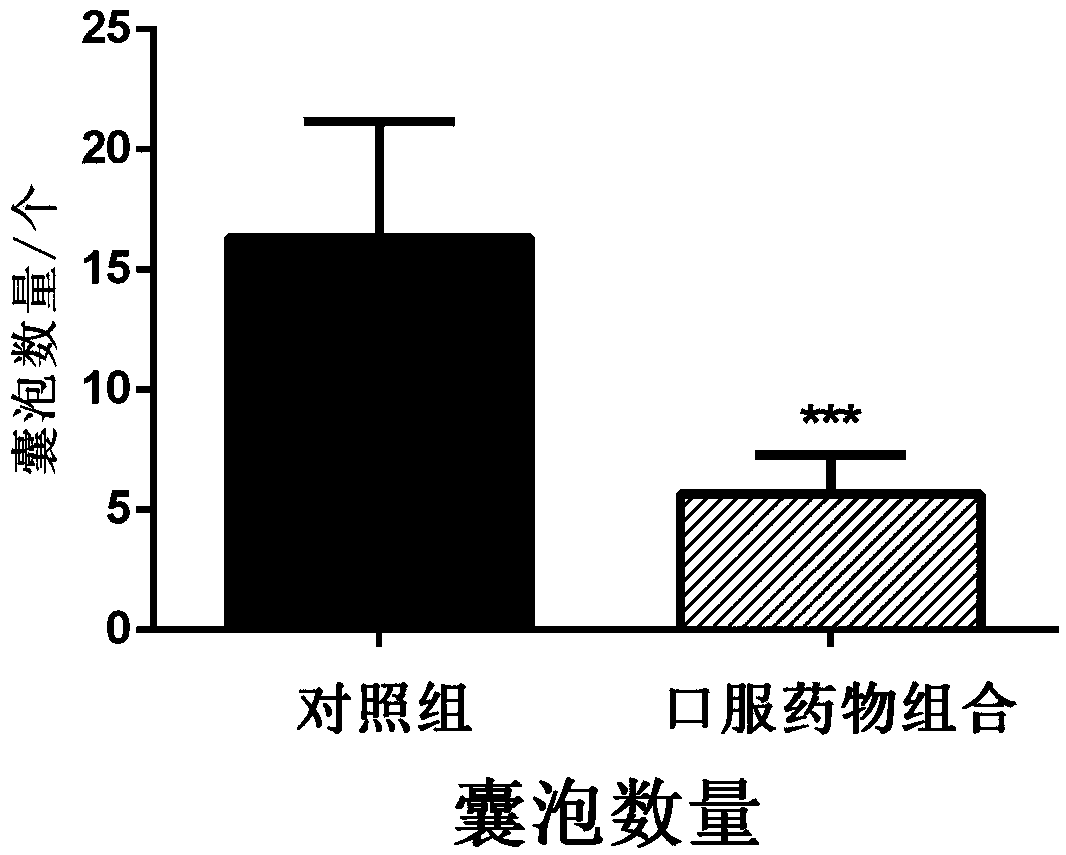 Echinococcosis treating drug combination and preparation, and application thereof