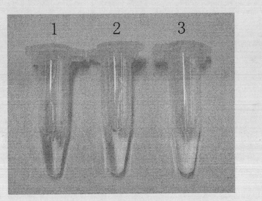 Kit for detecting G119S mutation of culex acetylcholinesterase