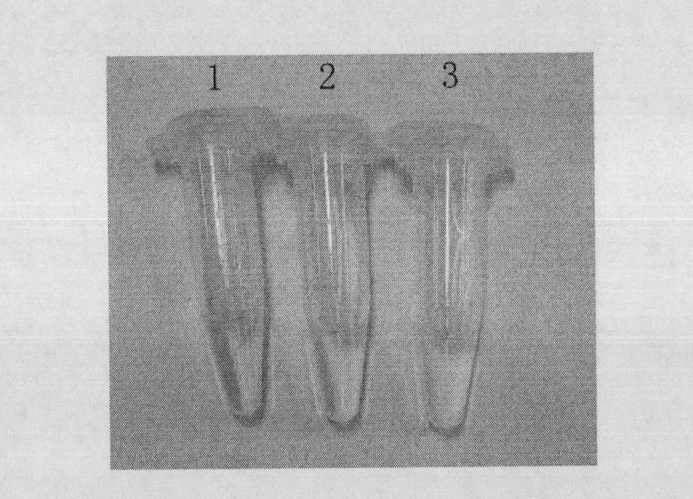 Kit for detecting G119S mutation of culex acetylcholinesterase