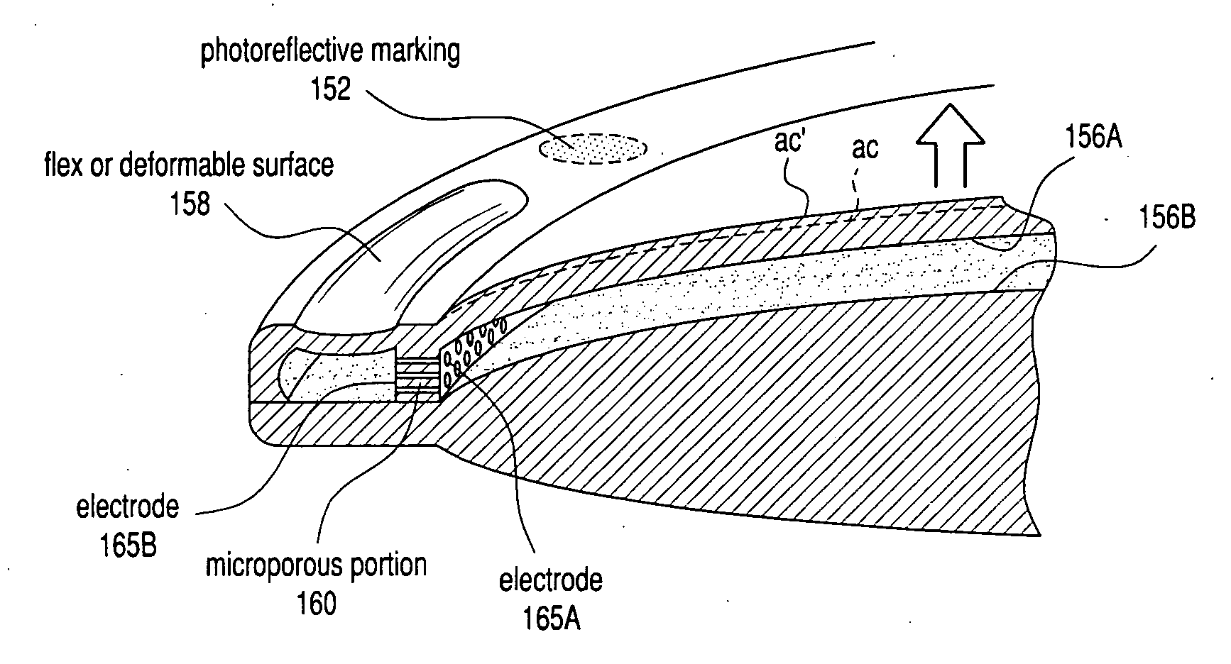 Intraocular lens system and method for power adjustment