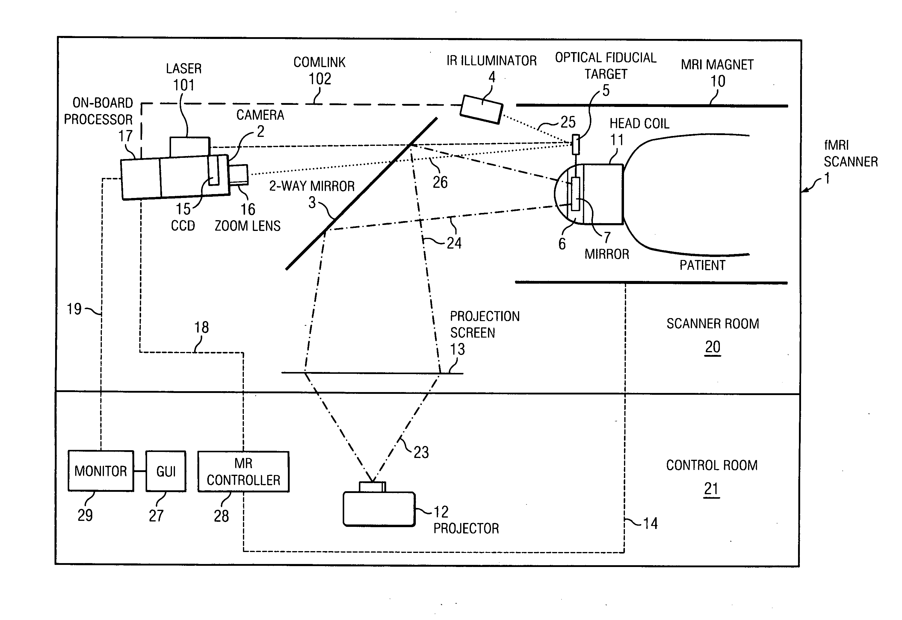 Single camera motion measurement and monitoring for magnetic resonance applications