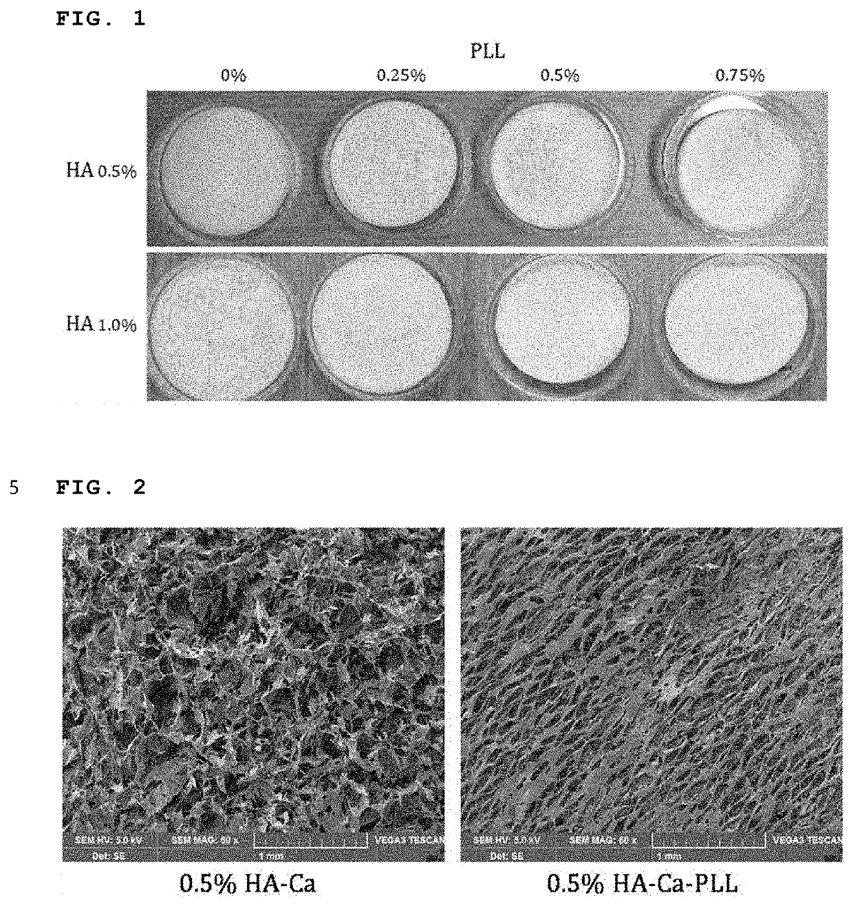 Wound dressing comprising hyaluronic acid-calcium and polylysine and manufacturing method therefor