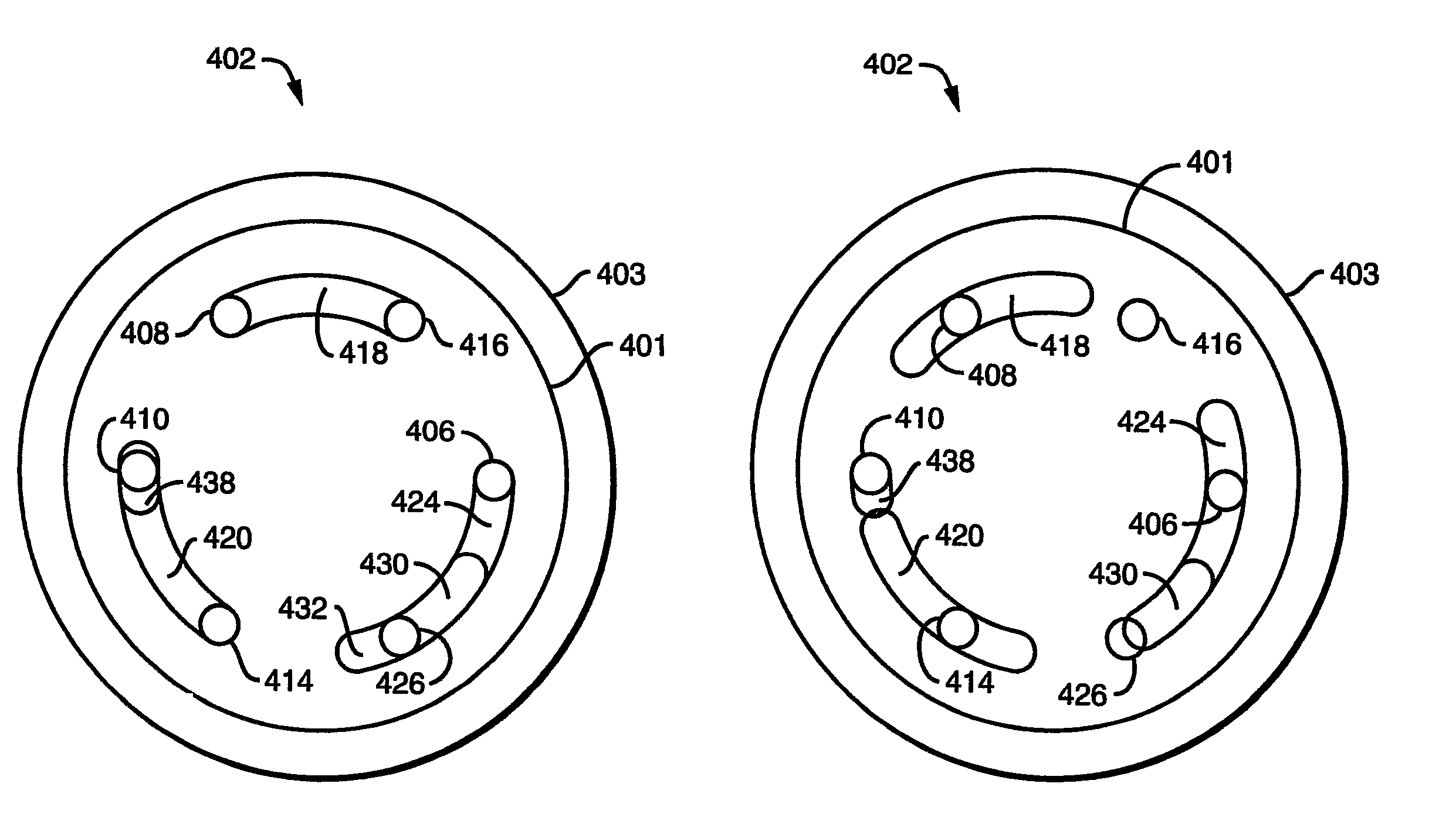 Method and apparatus for sample injection in liquid chromatography