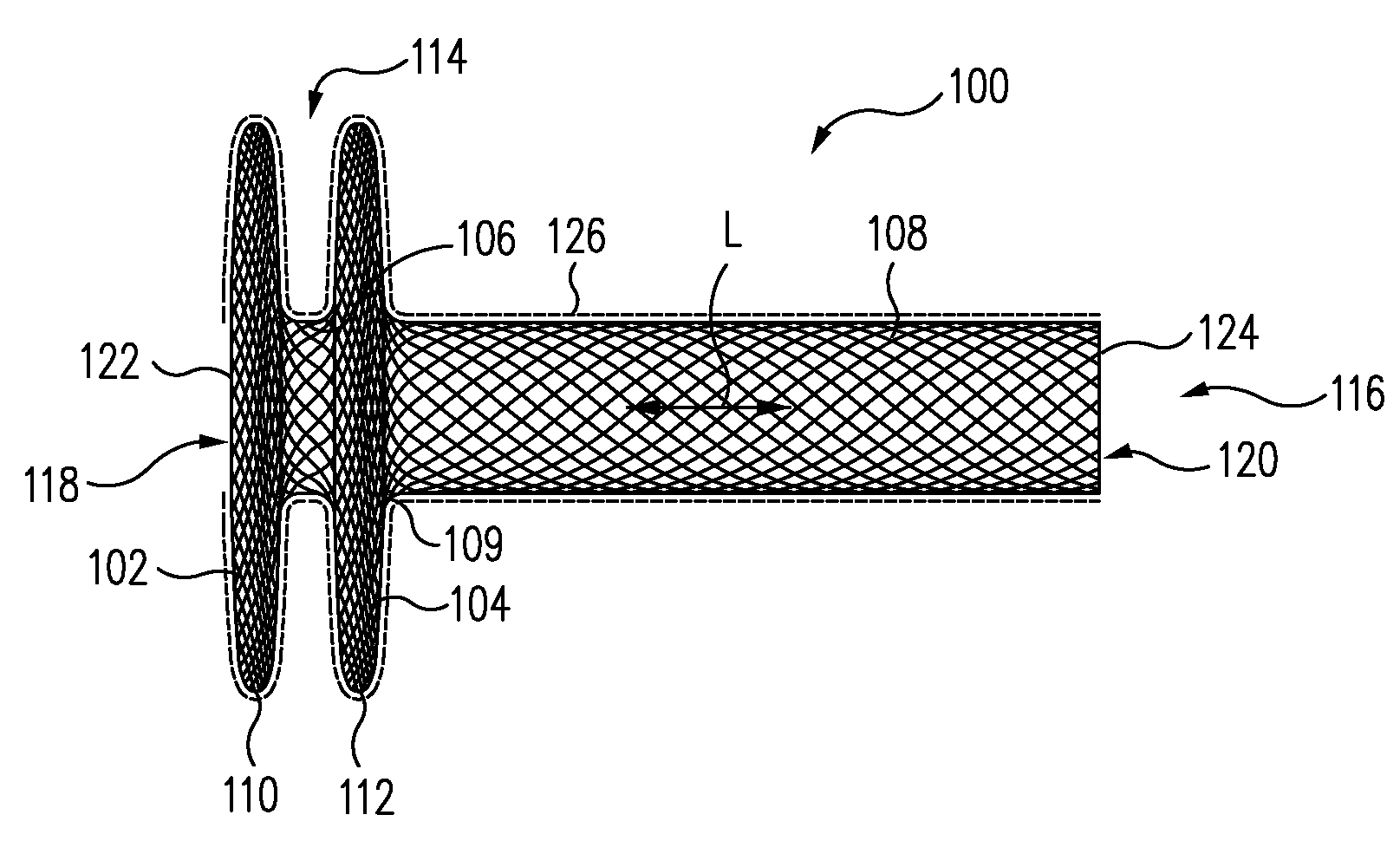 Braided Flange Branch Graft for Branch Vessel