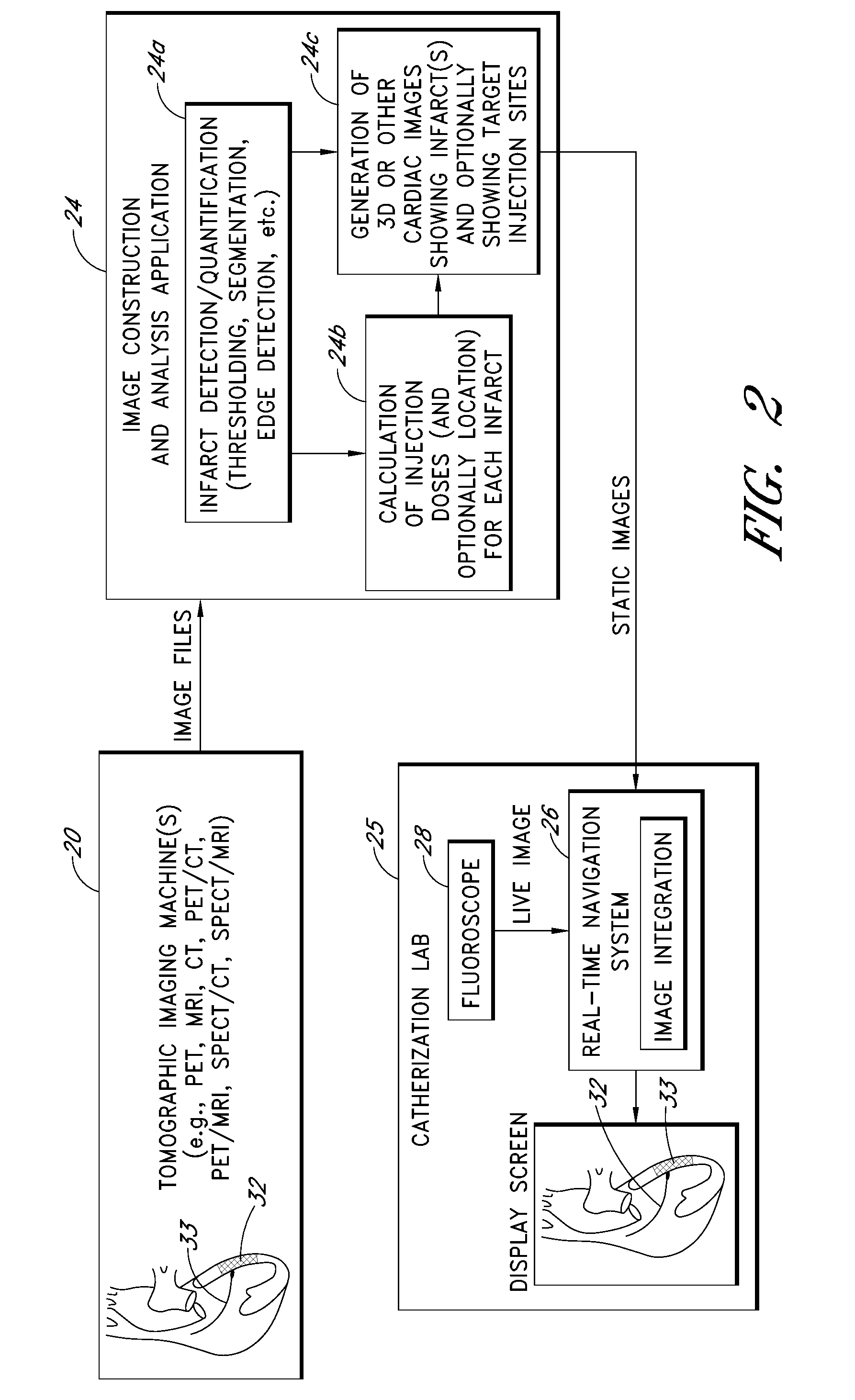 Computer-assisted identification and treatment of affected organ tissue