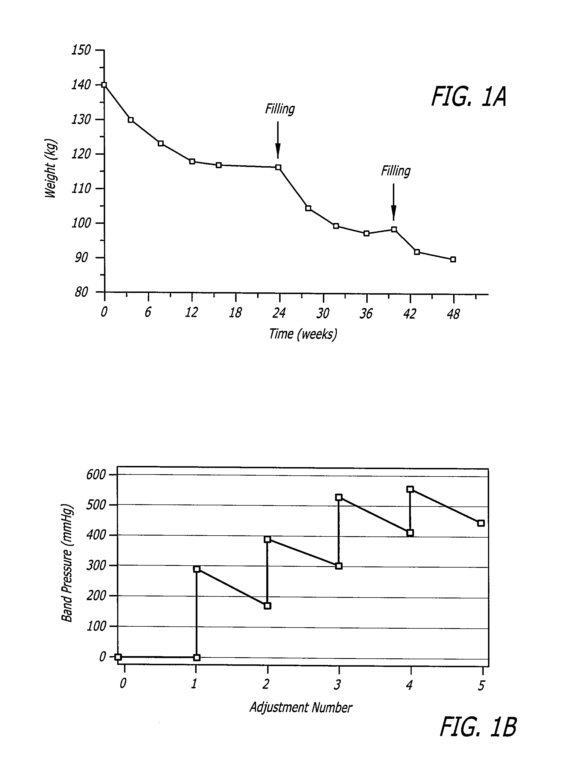 Assembly and method for automatically controlling pressure for a gastric band