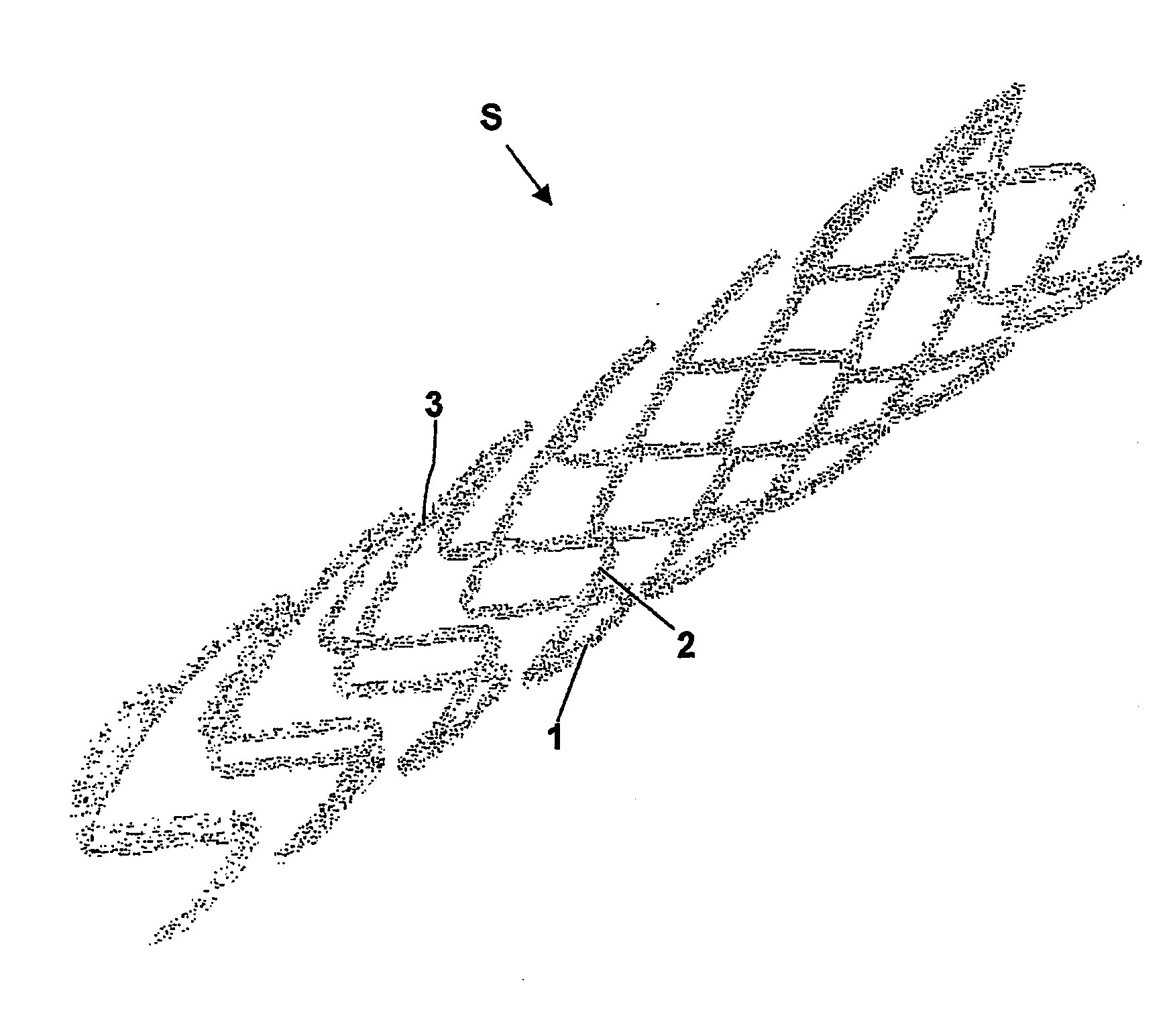 Endovascular prosthesis and relating manufacturing procedure