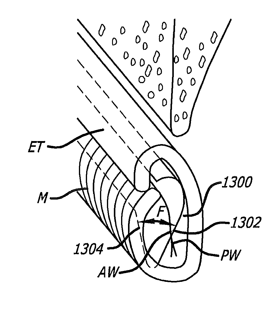 System and method for treatment of non-ventilating middle ear by providing a gas pathway through the nasopharynx