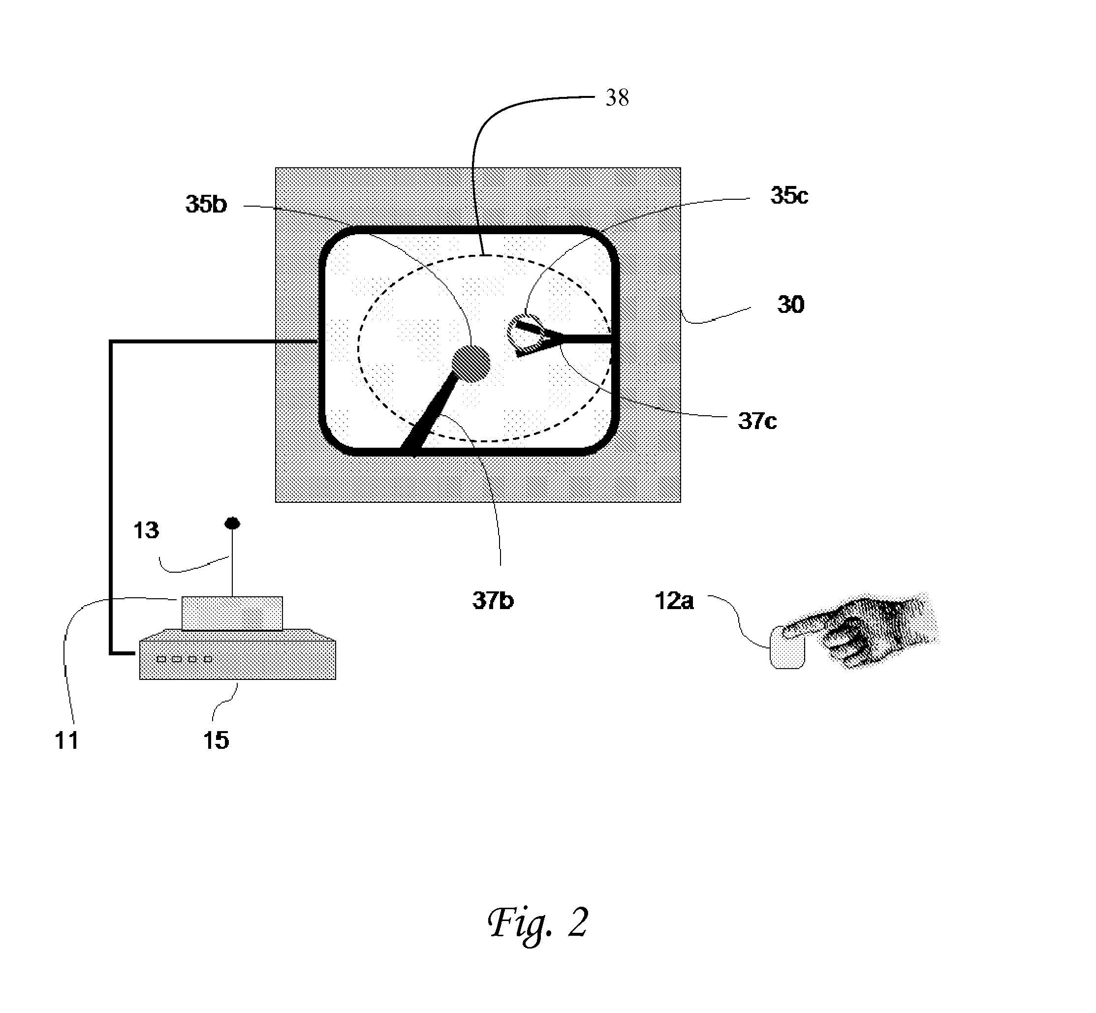 Device and method for assisting laparoscopic surgery - rule based approach