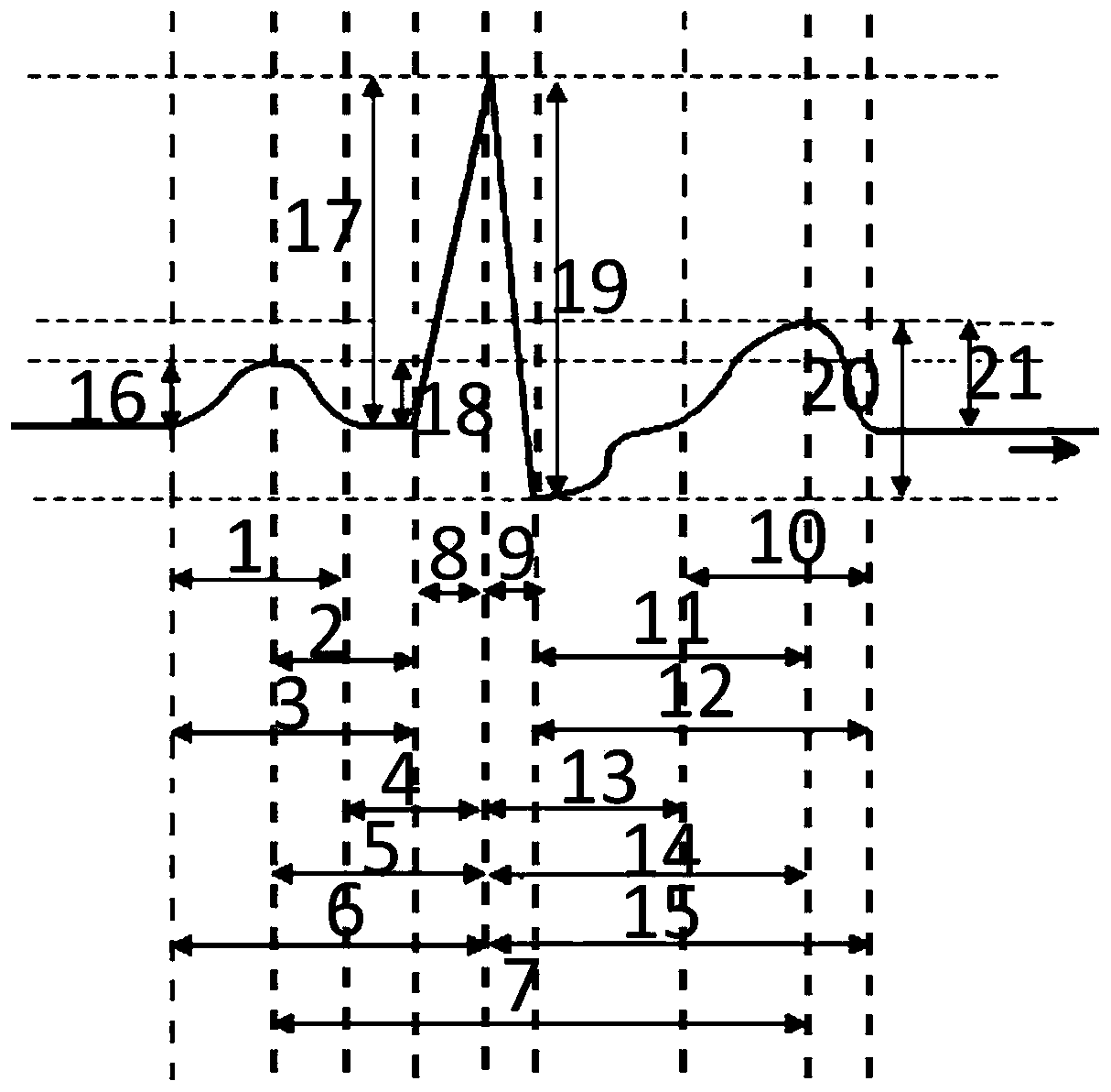 Electrocardio signal identification method and system based on multi-feature sparse representation