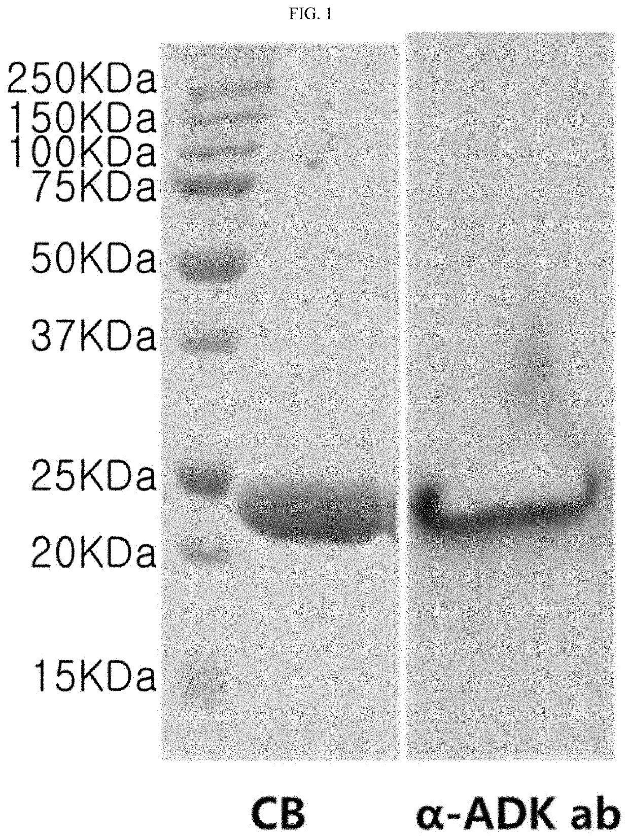 Antibacterial composition containing ADK protein as active ingredient, or composition for preventing or treating sepsis