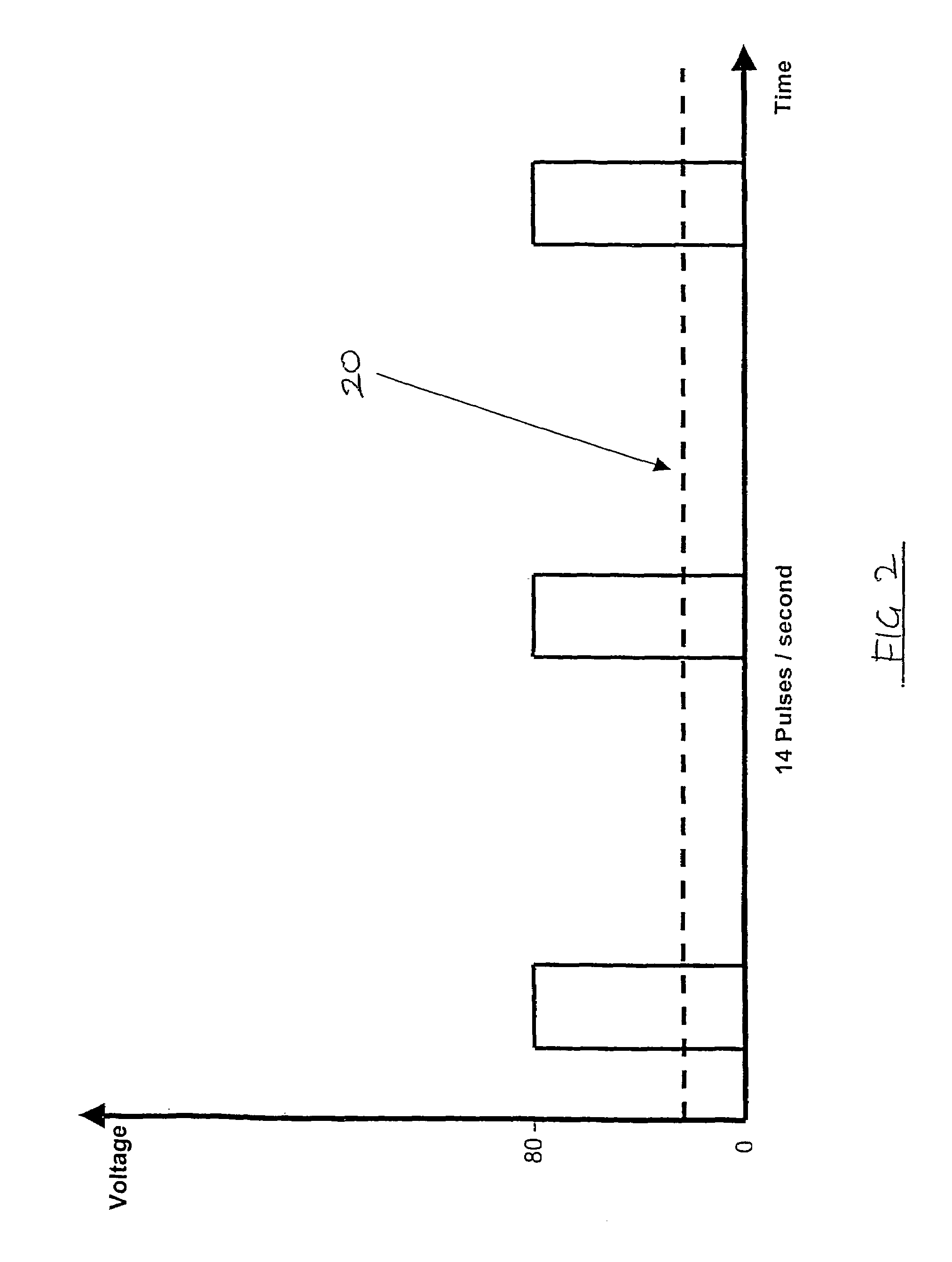 Electrical treatment of carcasses