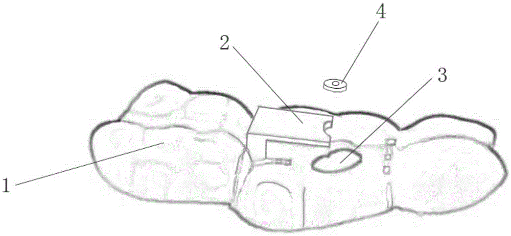 Navigation device for root canal treatment and making method thereof